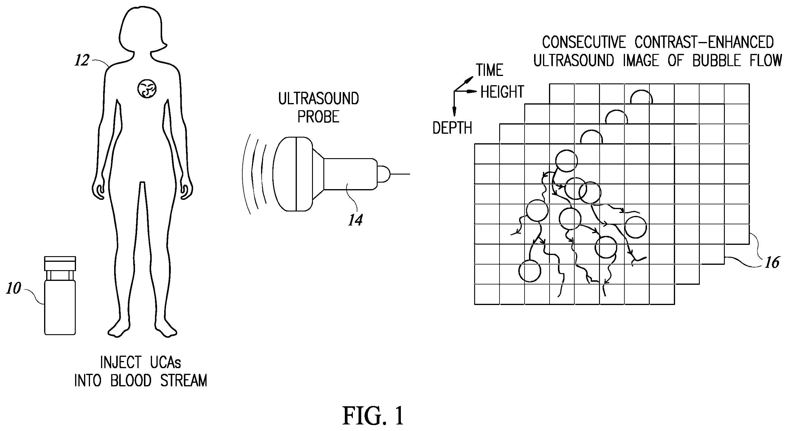 Patent US12614250 Figure 1 – Learned super resolution ultrasound for improved breast lesion characterization