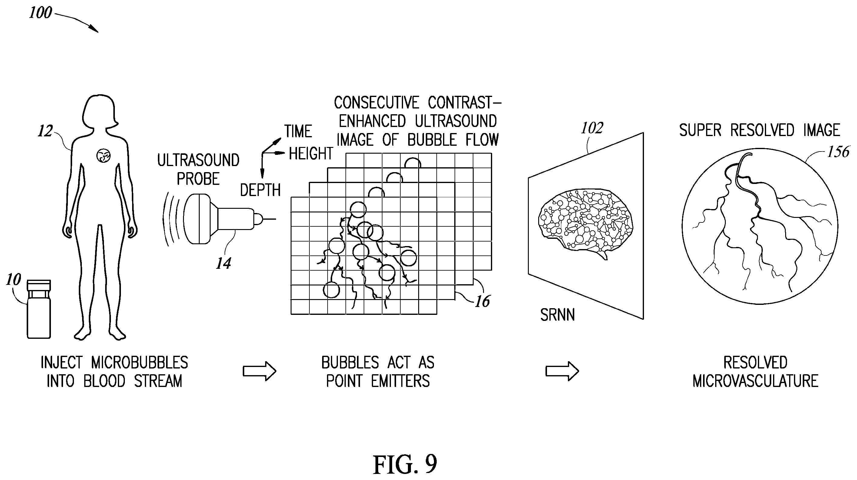 Patent US12614250 Figure 7 – Learned super resolution ultrasound for improved breast lesion characterization