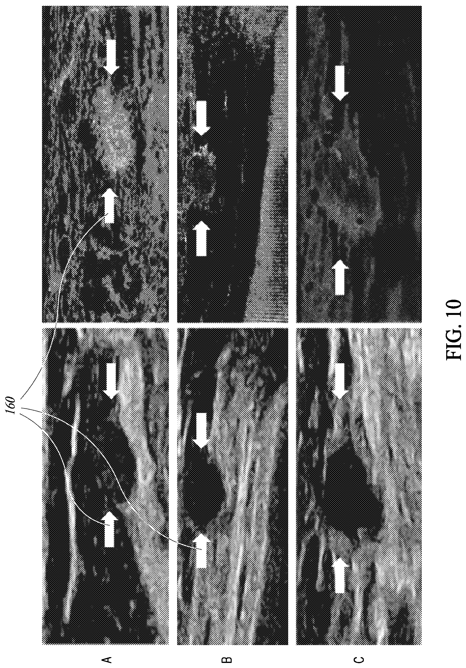Patent US12614250 Figure 8 – Learned super resolution ultrasound for improved breast lesion characterization