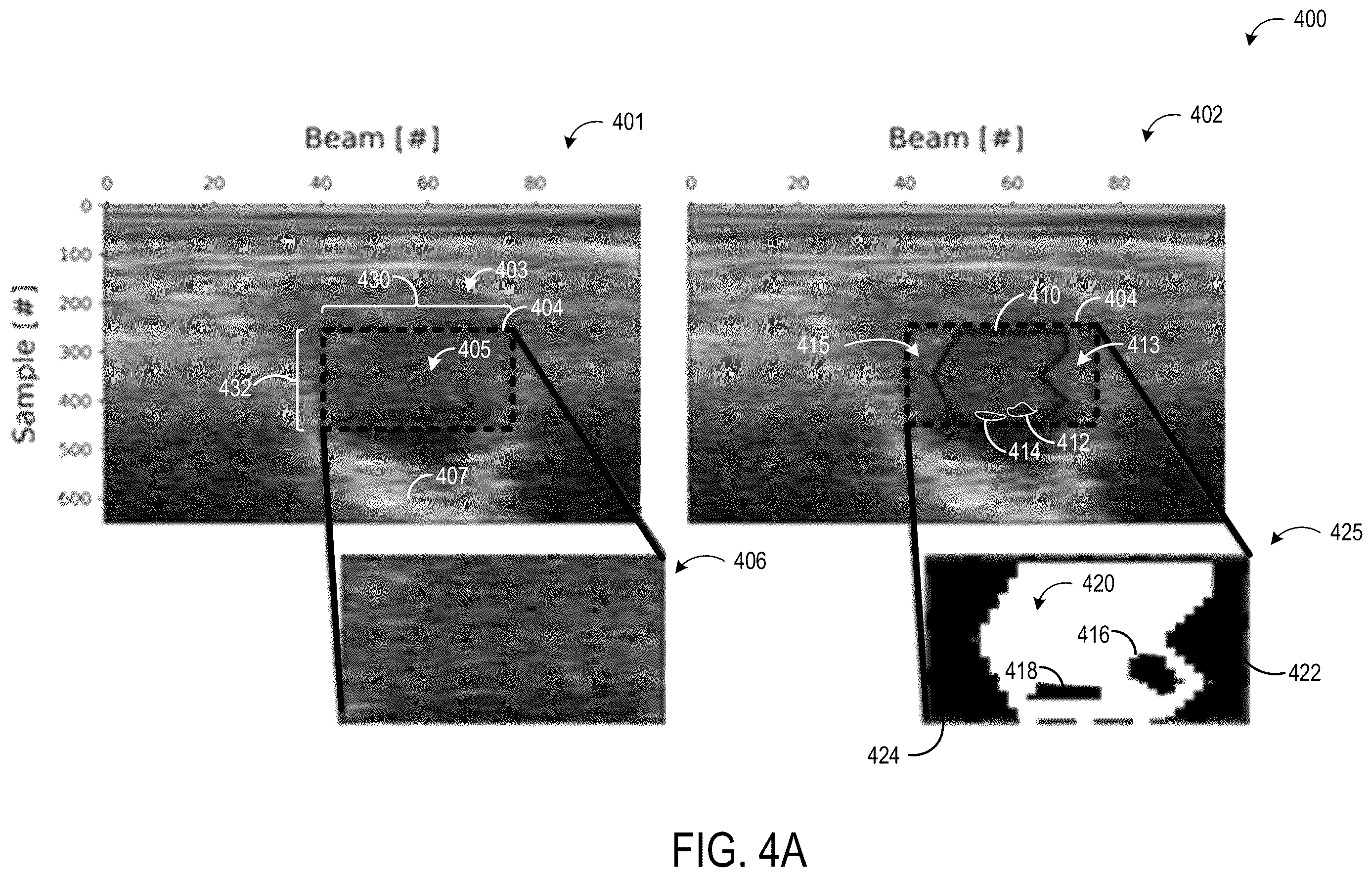 Patent US12614257 Figure 5 – Systems and methods for clutter artifact removal using a data-driven model trained on images formed using a lower clutter image sequence and a higher clutter image sequence generated by an artifact overlay on the lower clutter image sequence