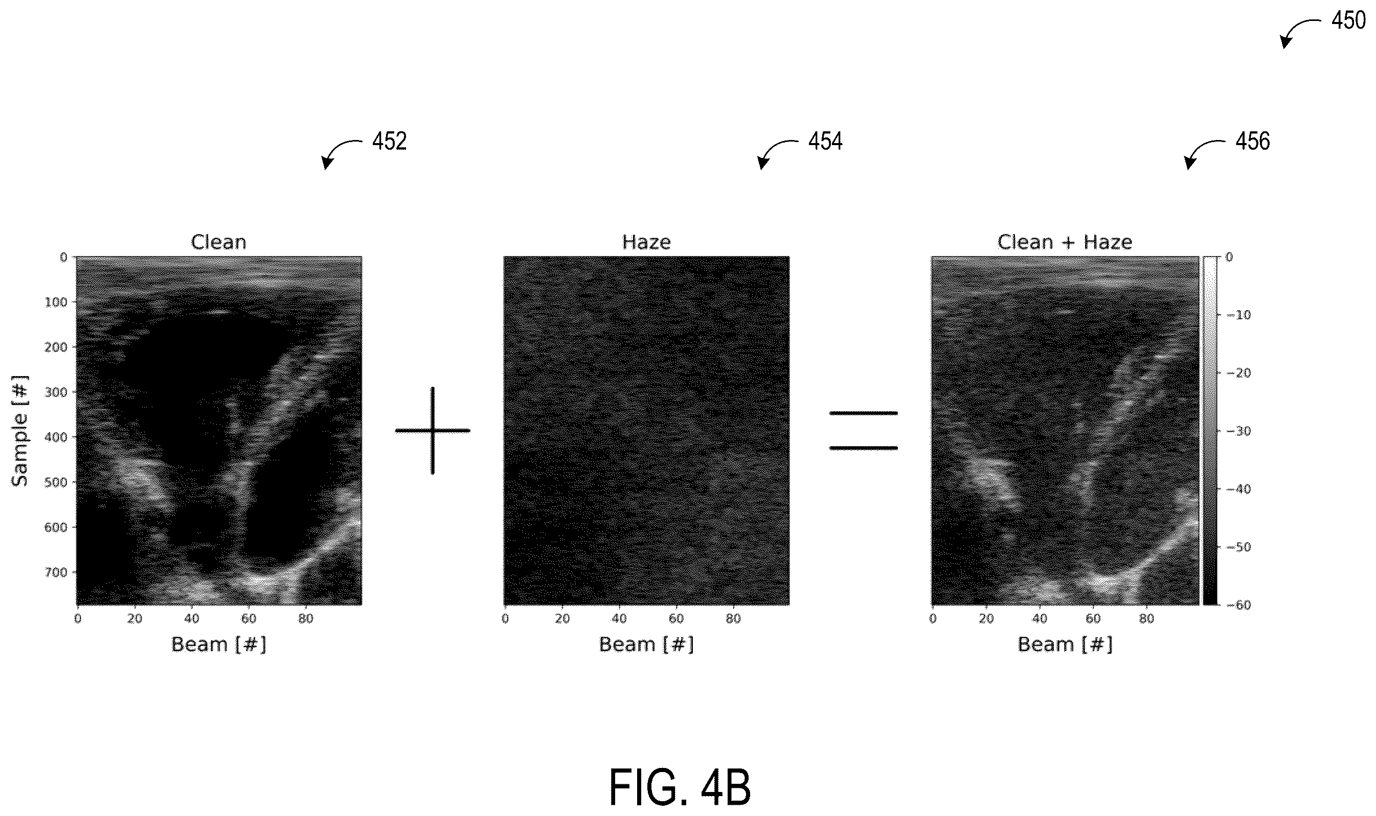 Patent US12614257 Figure 6 – Systems and methods for clutter artifact removal using a data-driven model trained on images formed using a lower clutter image sequence and a higher clutter image sequence generated by an artifact overlay on the lower clutter image sequence