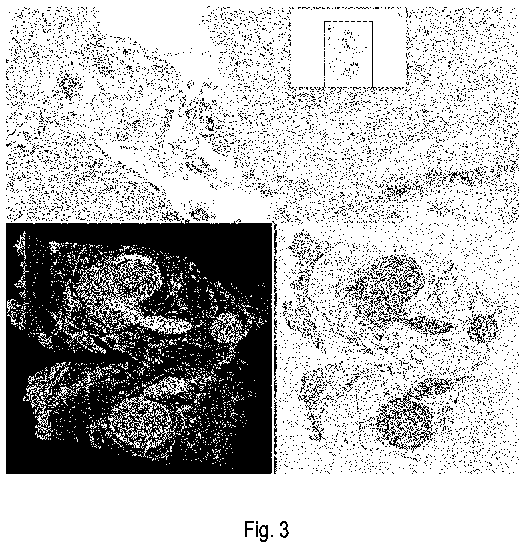 Patent US12614265 Figure 3 – Computer-implemented method for quality control of a digital image of a sample