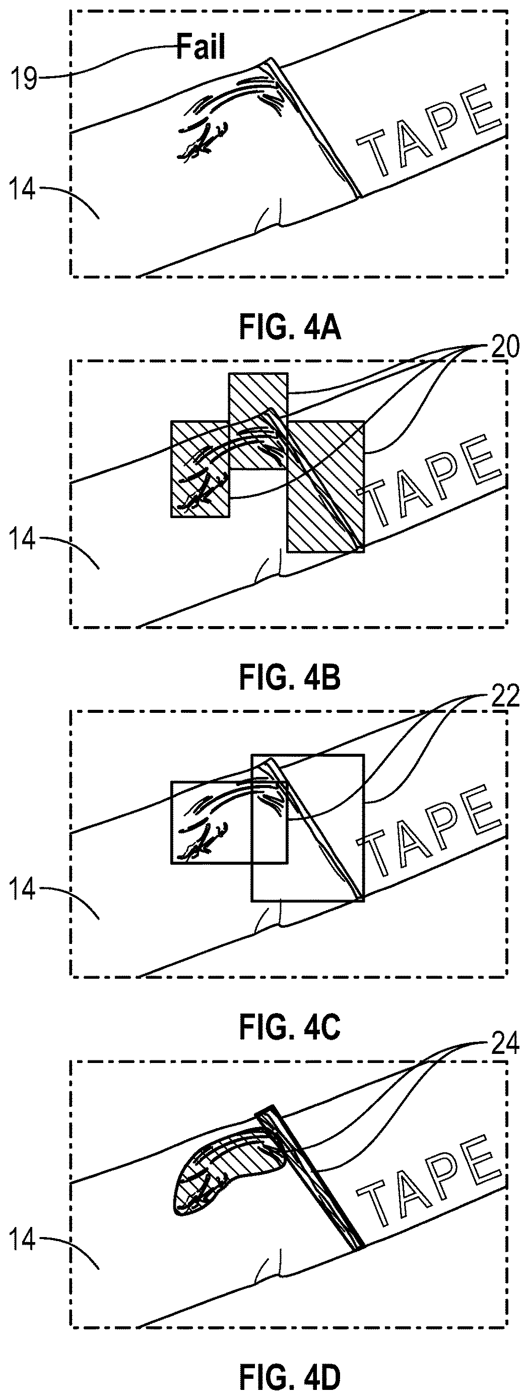 Patent US12614271 Figure 5 – Polarization image-based building inspection