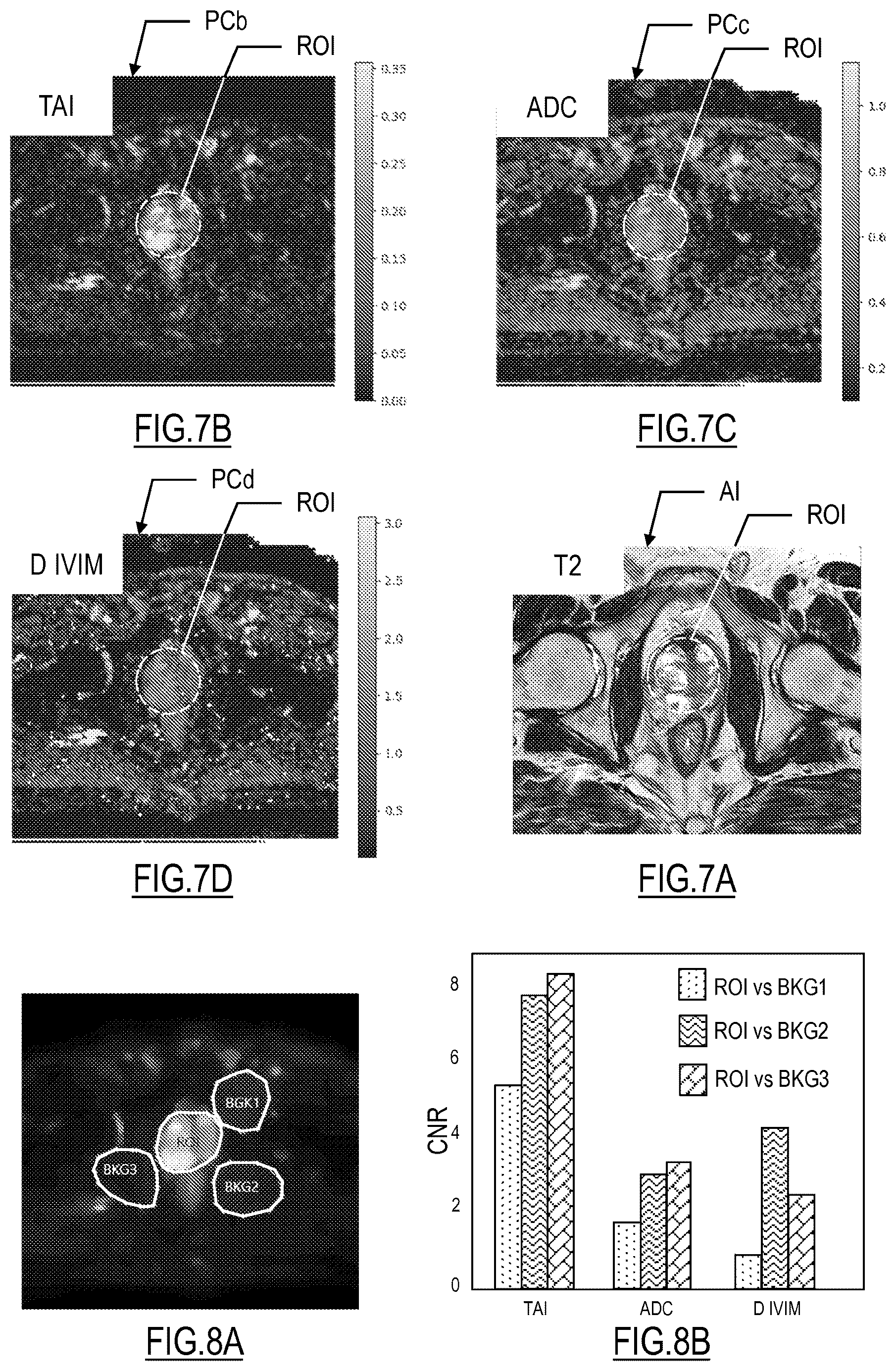 Patent US12614276 Figure 5 – System and method for estimating an indicator of the tissue activity of an organ