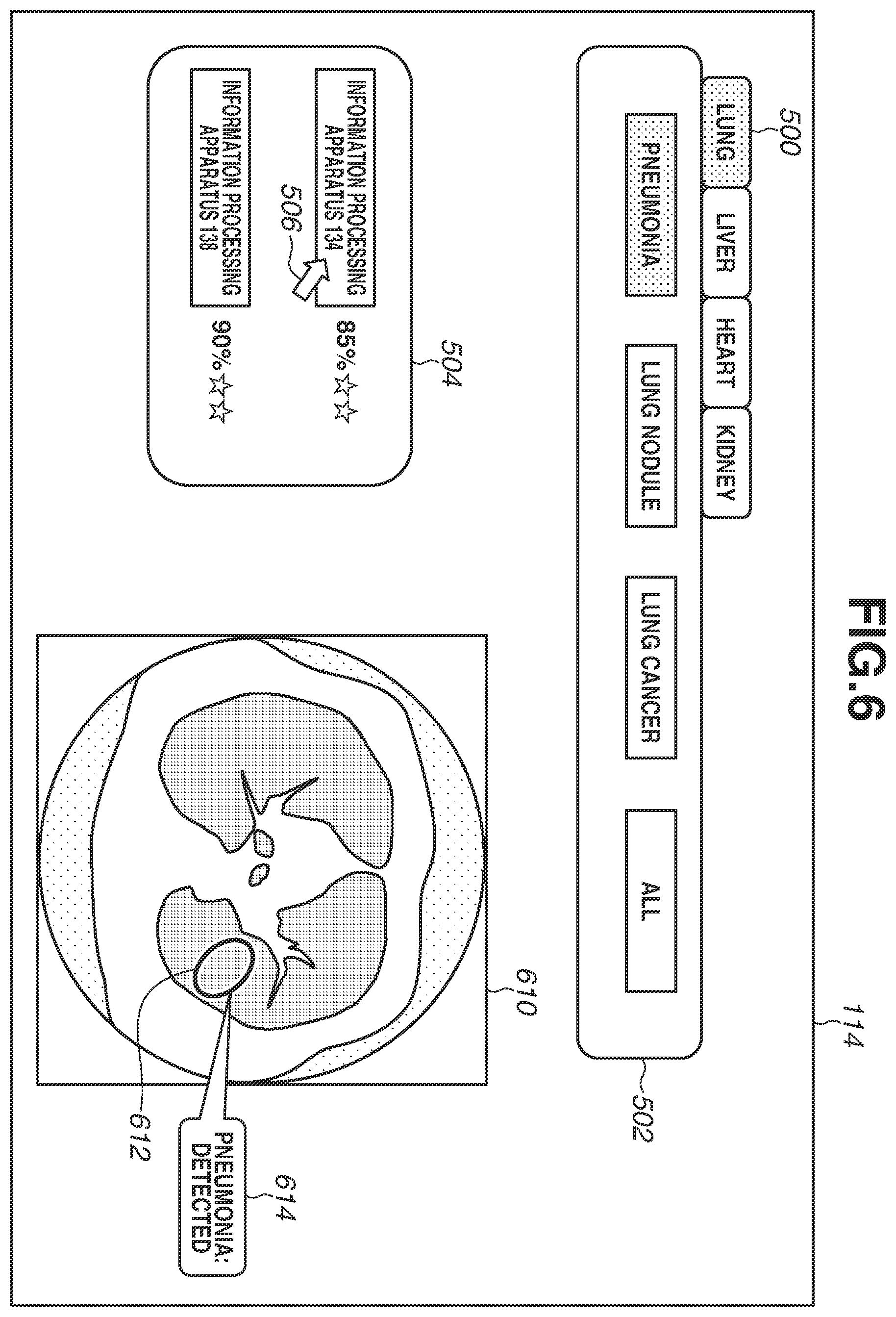 Patent US12614279 Figure 6 – Information processing system for medical image data, information processing method, information terminal, and non-transitory computer-readable medium