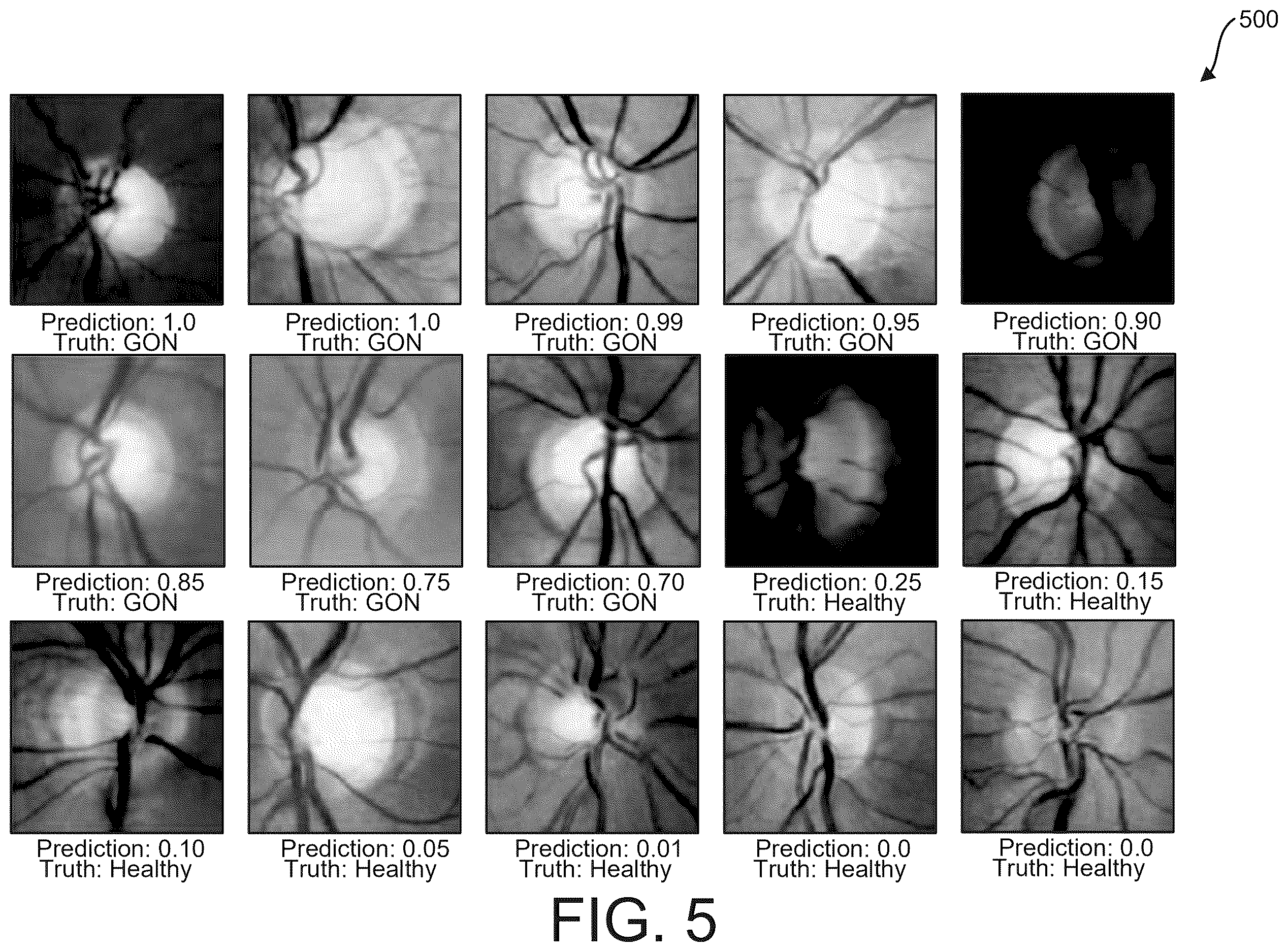 Patent US12614280 Figure 5 – System for estimating primary open-angle glaucoma likelihood