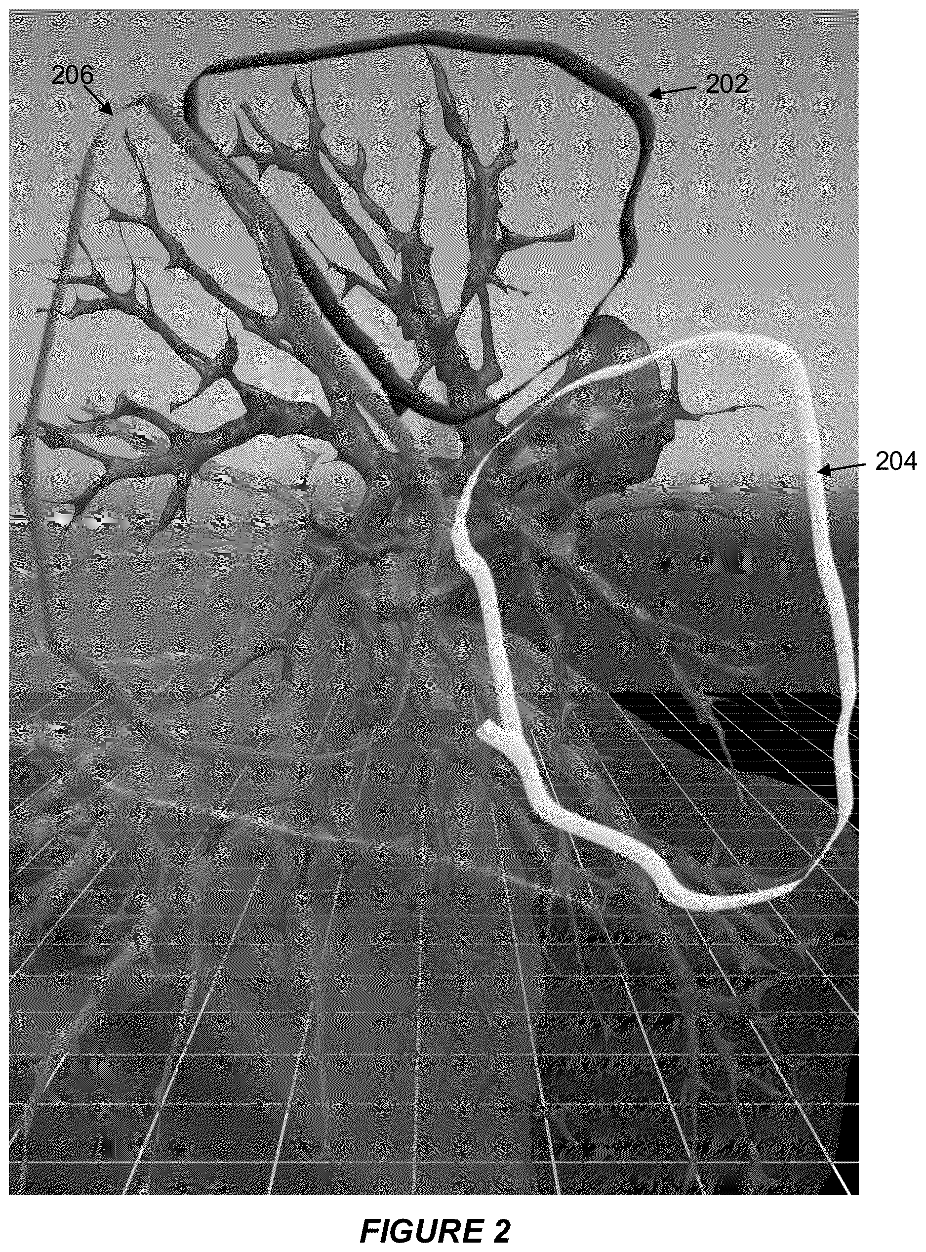 Patent US12614281 Figure 2 – Image analysis system for identifying lung features