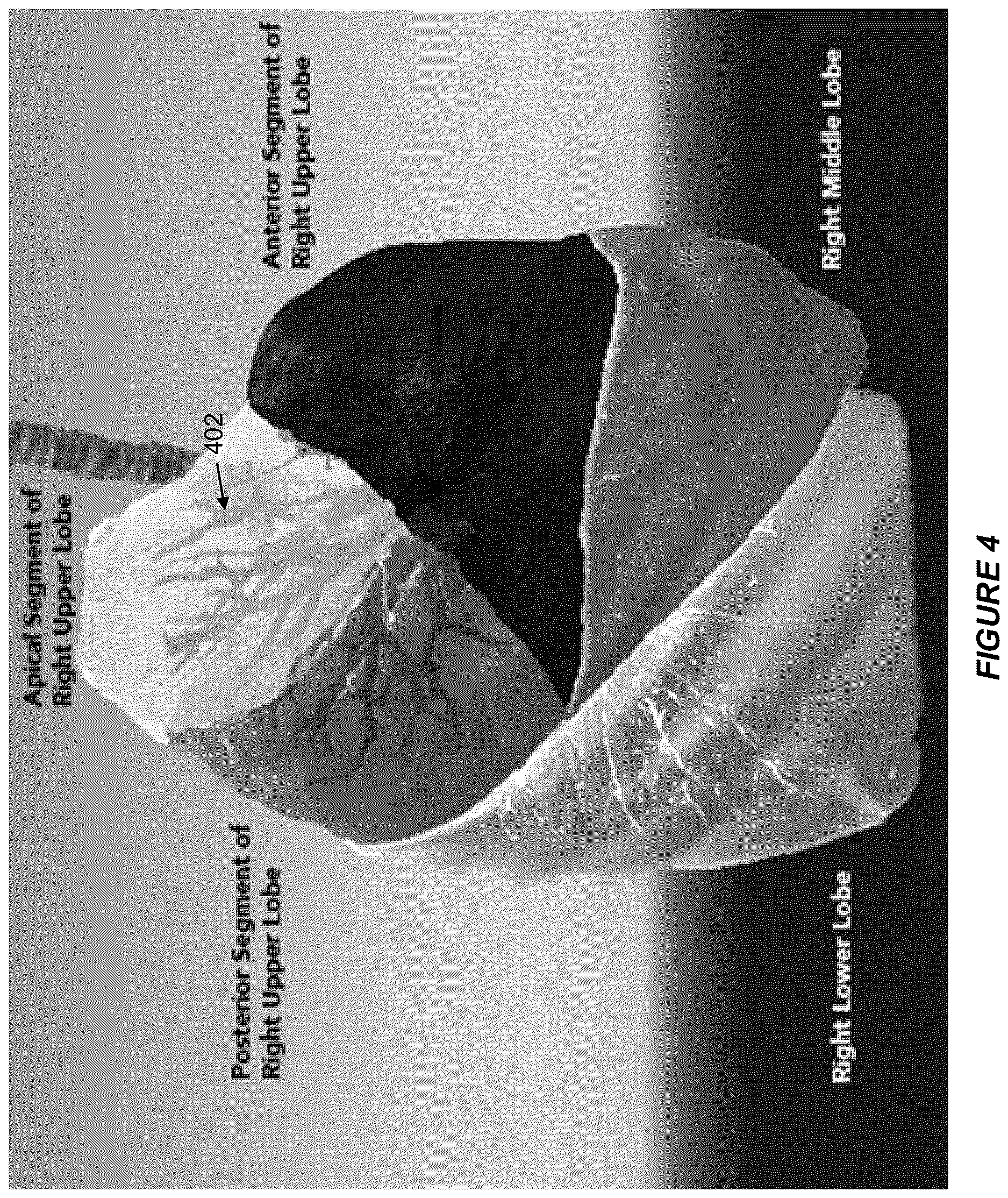 Patent US12614281 Figure 4 – Image analysis system for identifying lung features