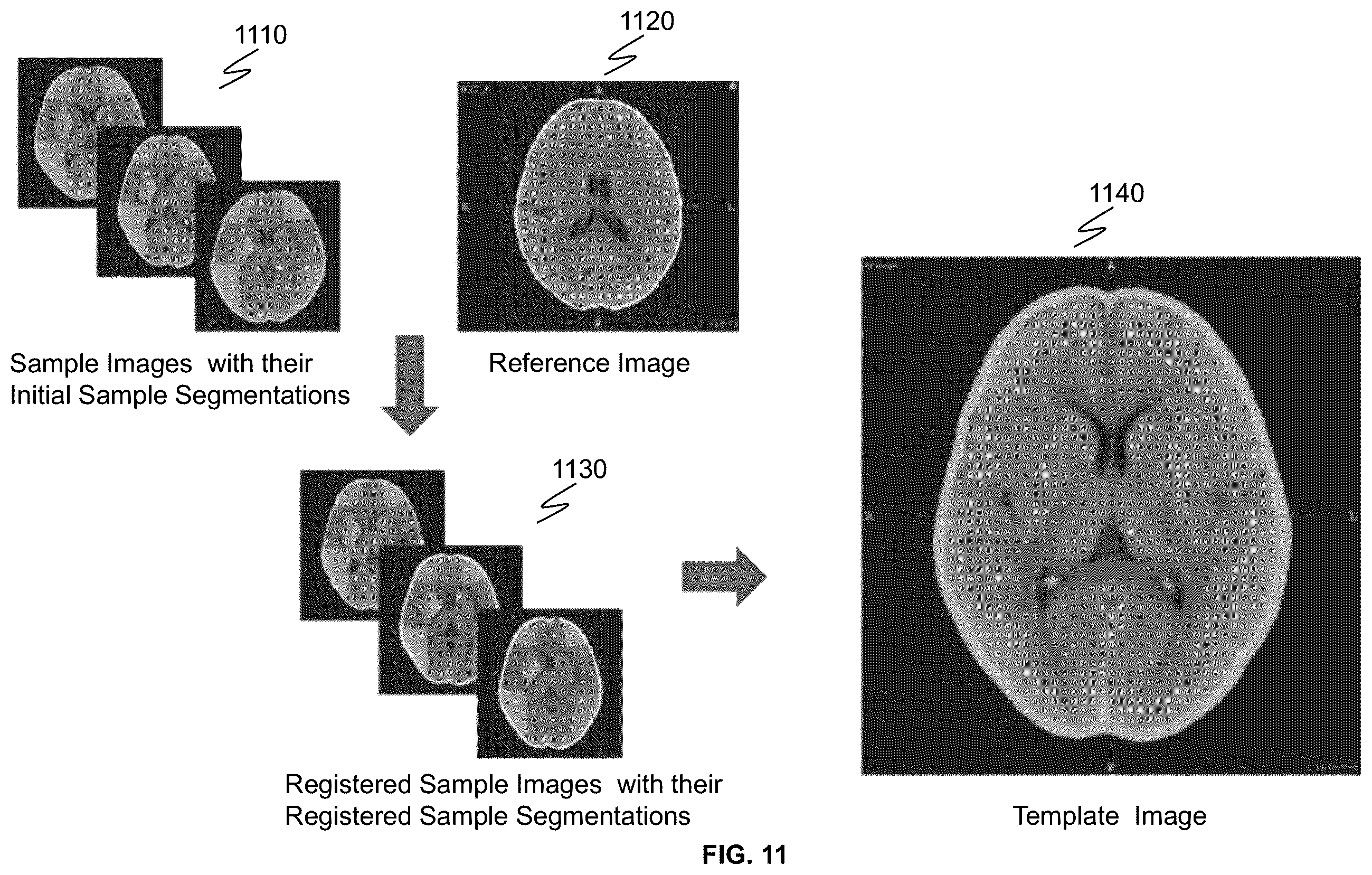 Patent US12614283 Figure 11 – Systems and methods for image segmentation