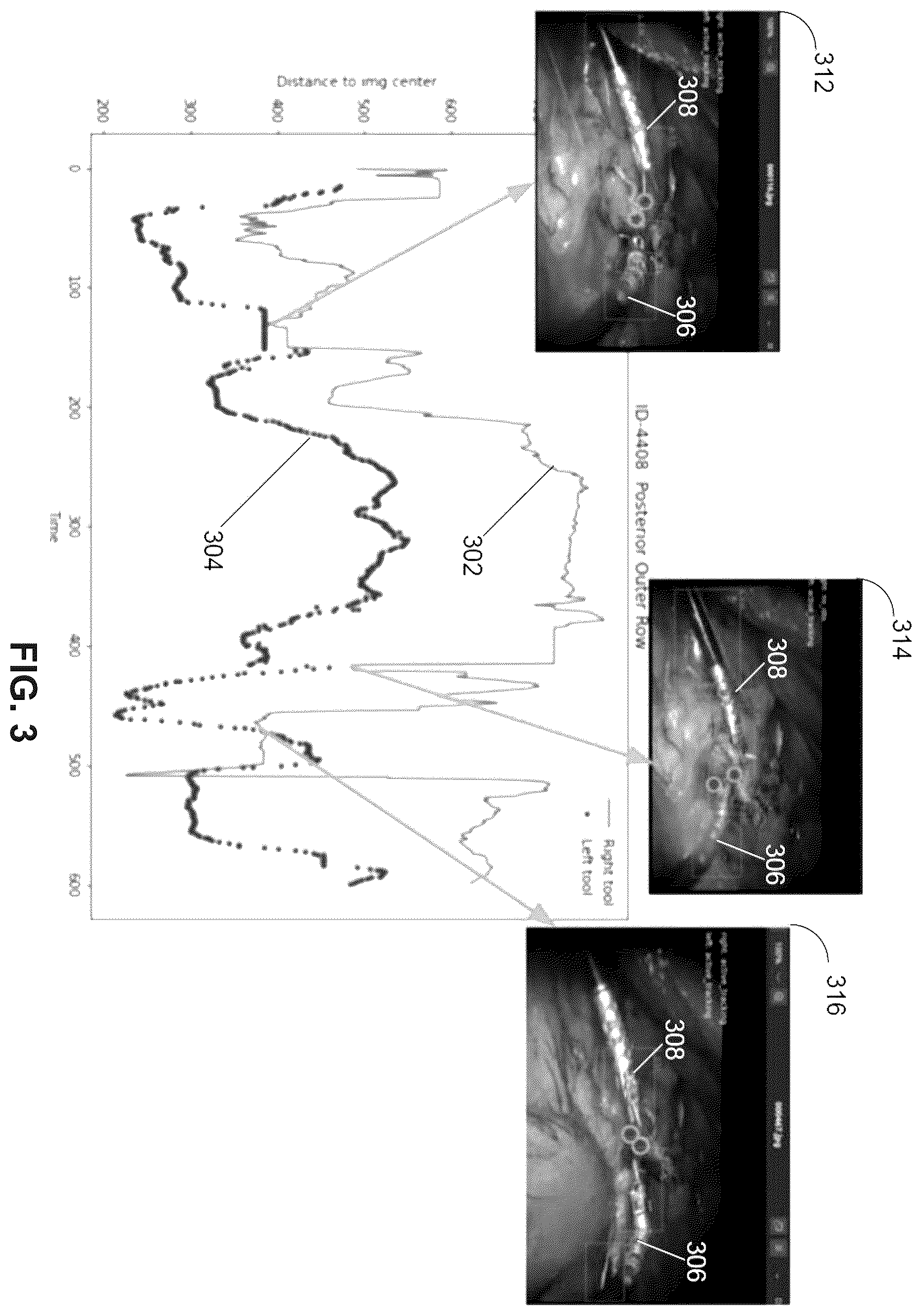 Patent US12614287 Figure 3 – Tracking multiple surgical tools in a surgical video