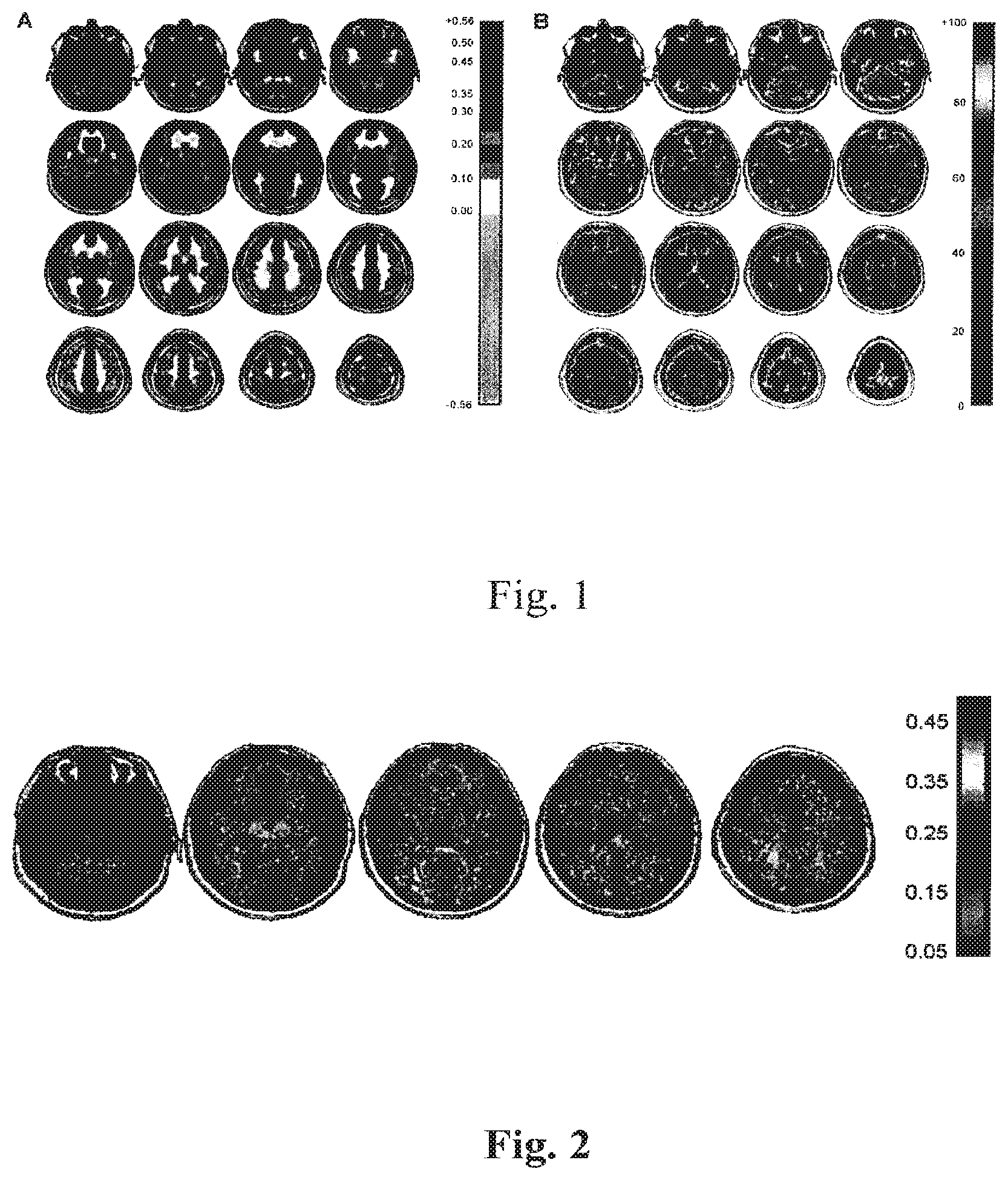 Patent US12614292 Figure 1 – Imaging abnormalities in vascular response