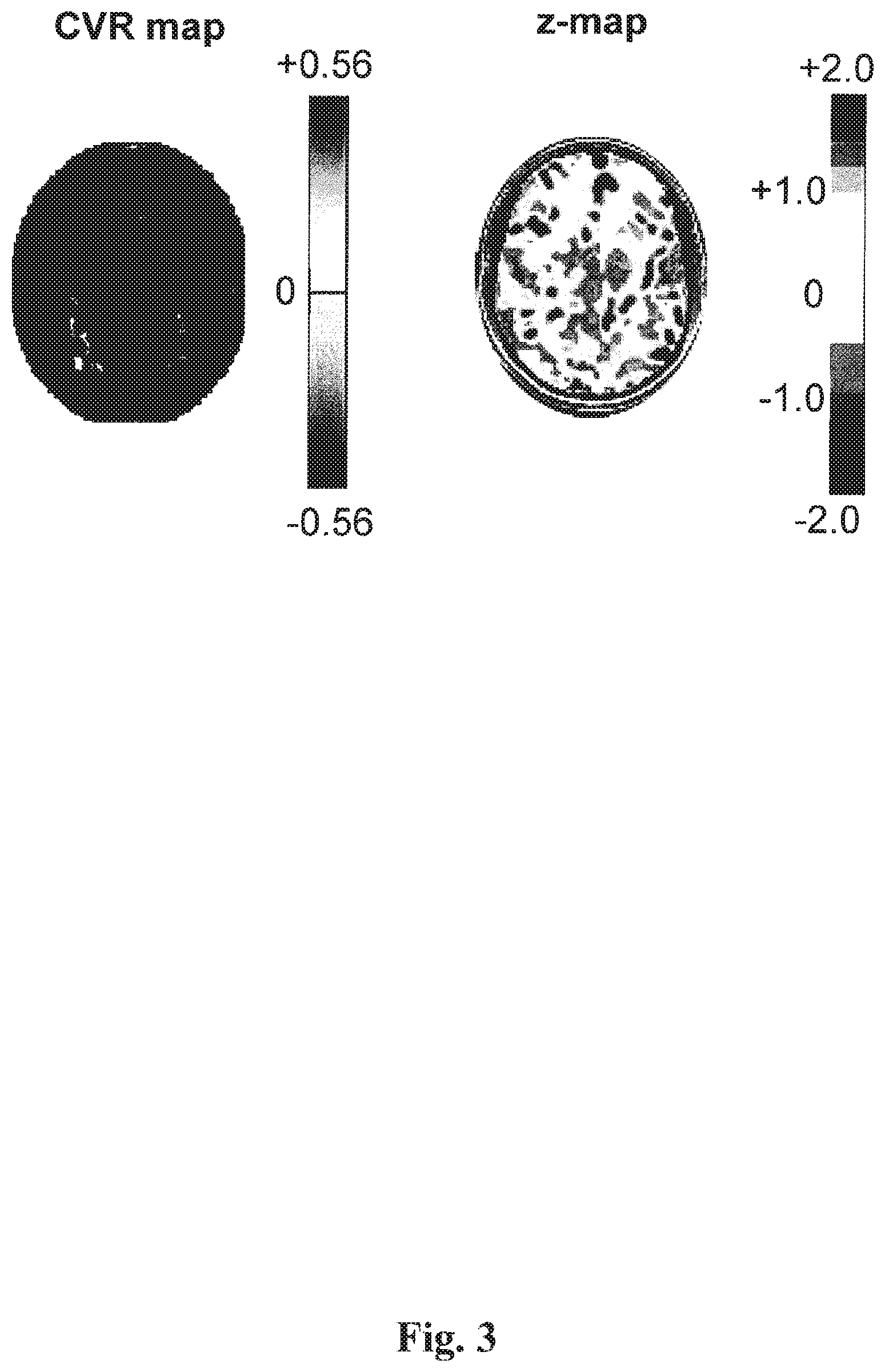 Patent US12614292 Figure 2 – Imaging abnormalities in vascular response