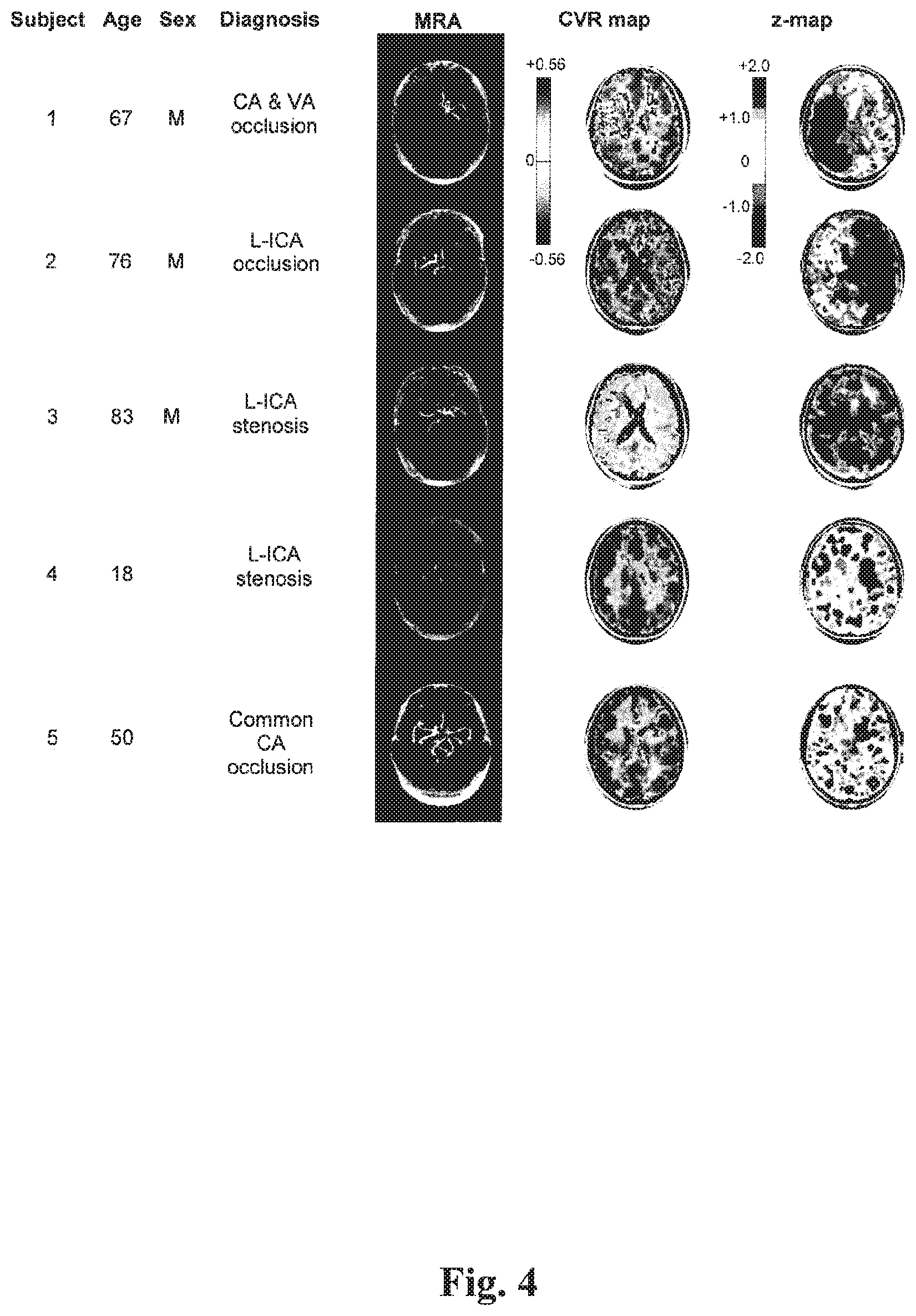 Patent US12614292 Figure 3 – Imaging abnormalities in vascular response