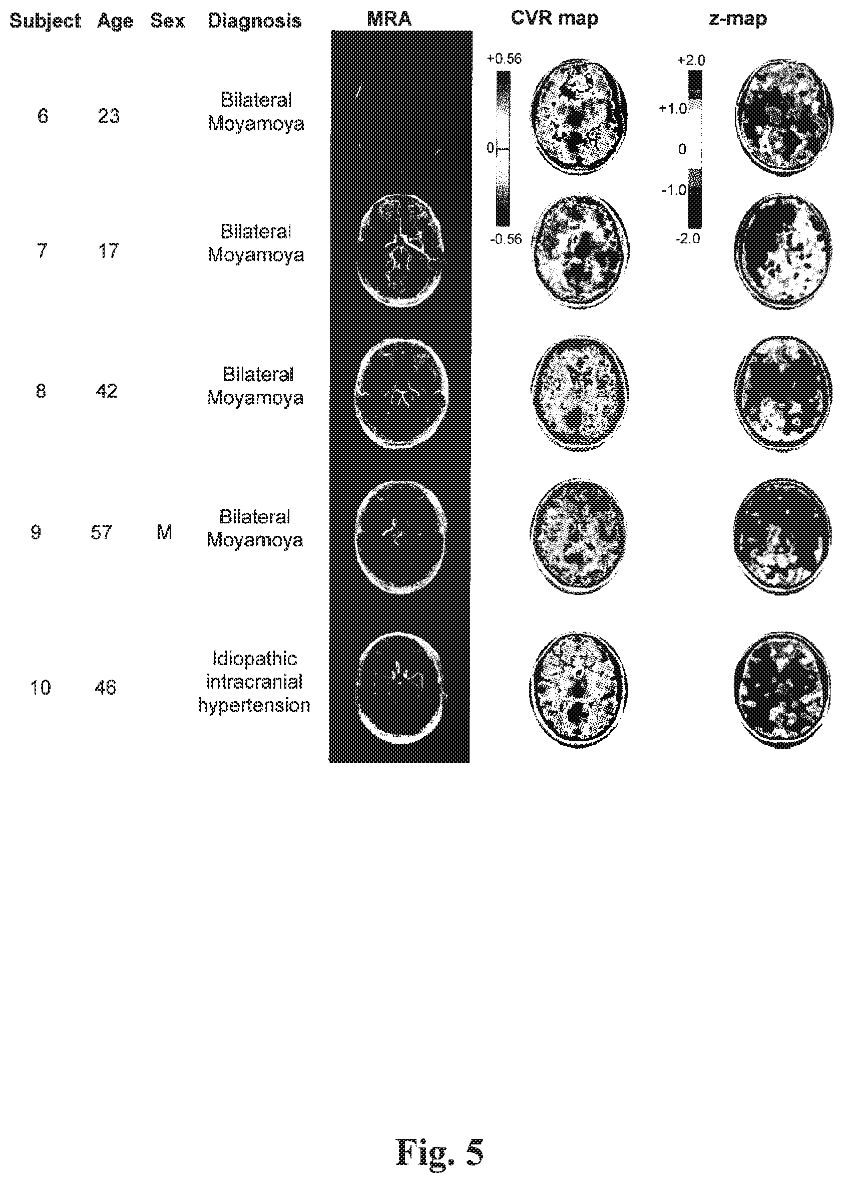 Patent US12614292 Figure 4 – Imaging abnormalities in vascular response