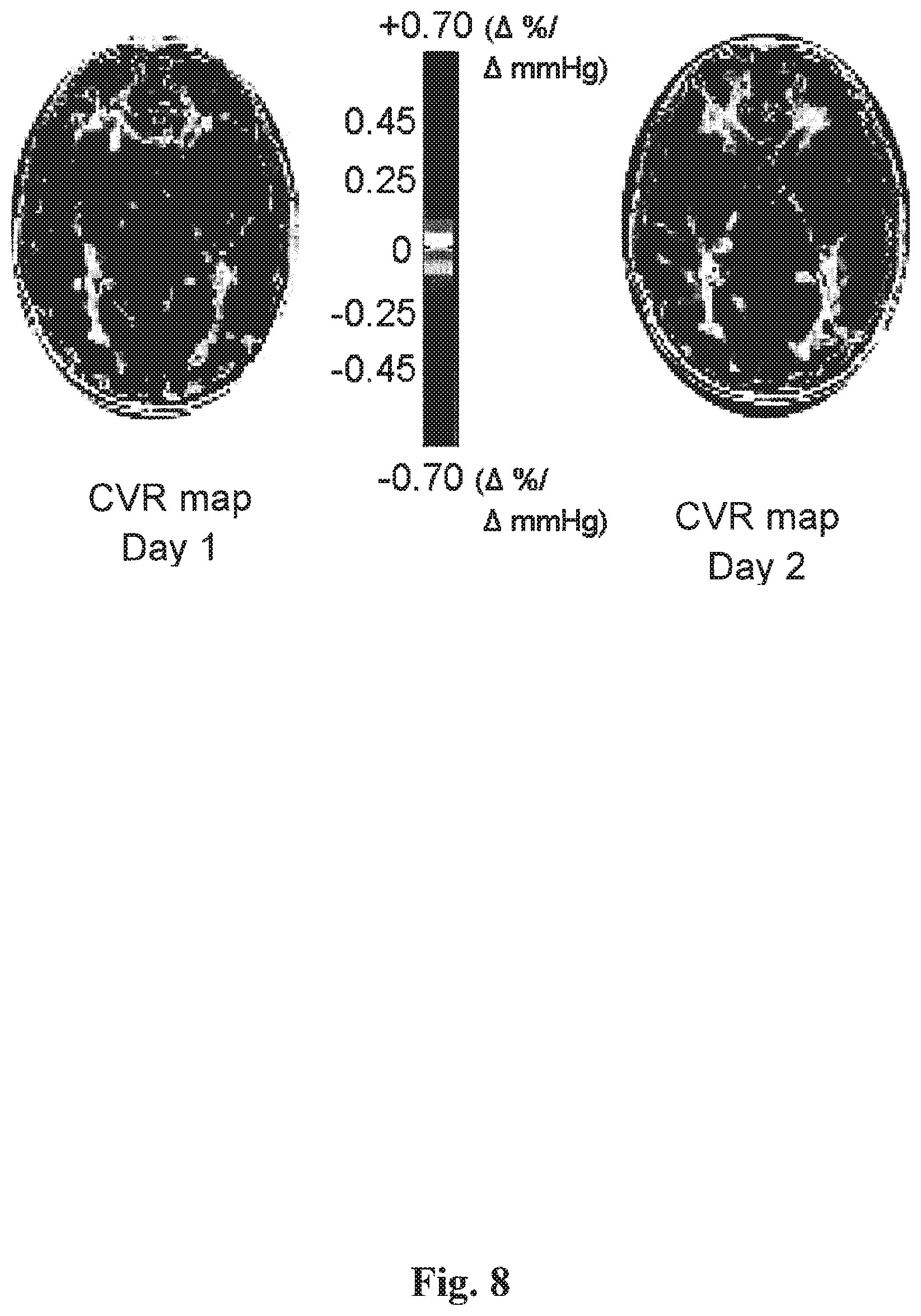 Patent US12614292 Figure 8 – Imaging abnormalities in vascular response