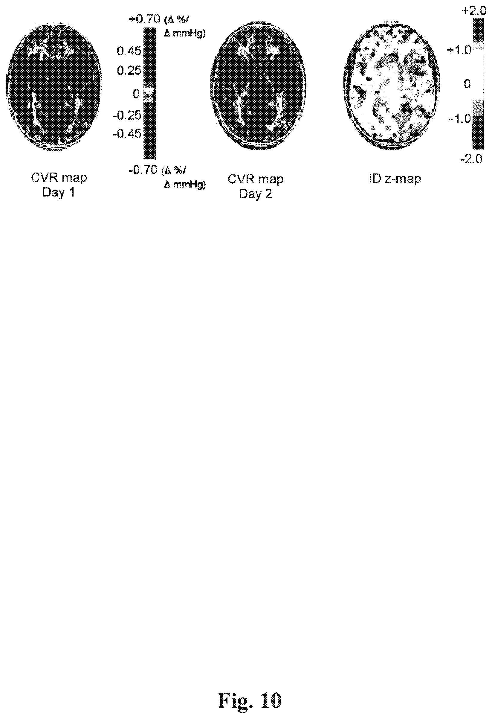 Patent US12614292 Figure 10 – Imaging abnormalities in vascular response