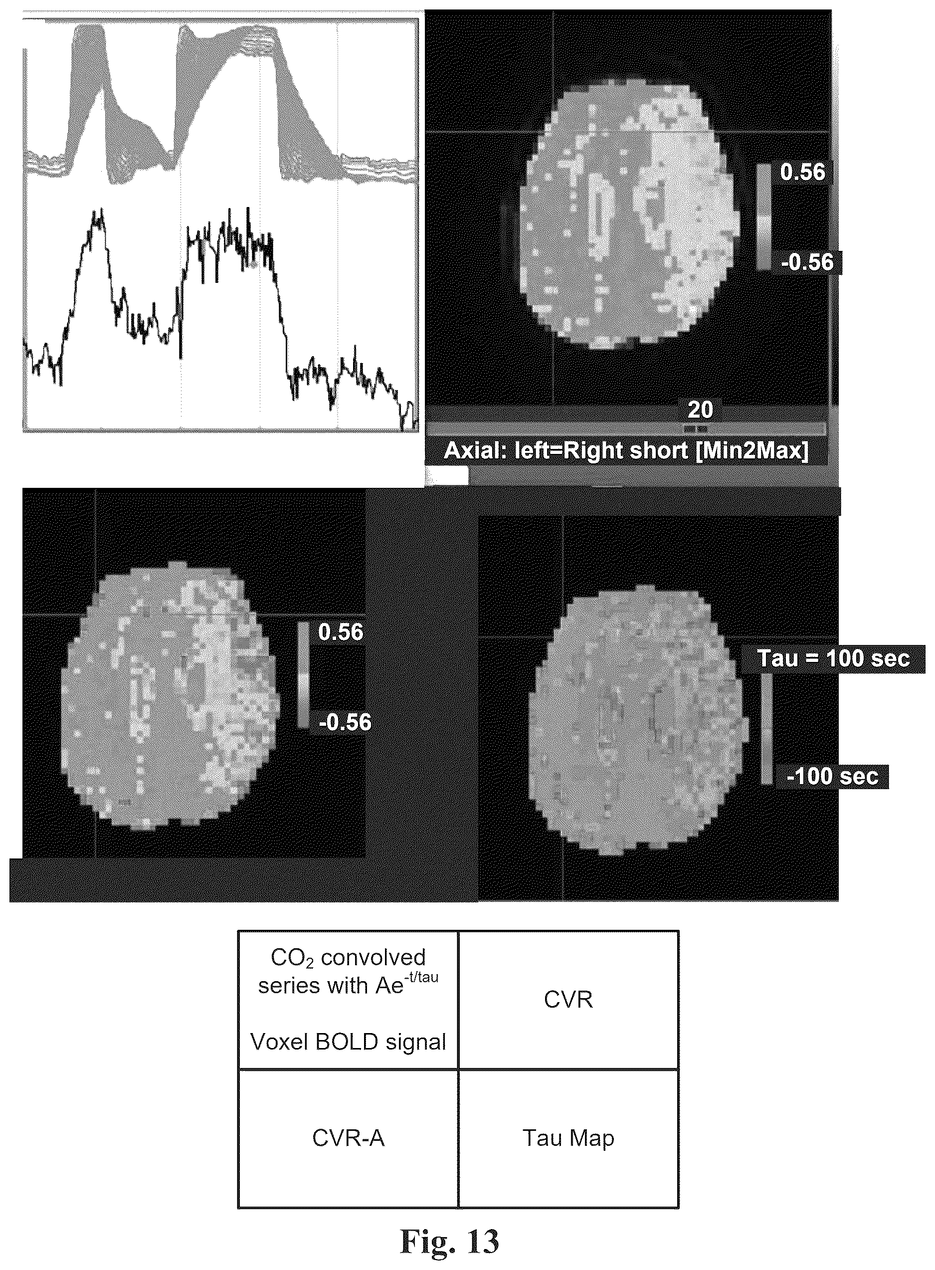 Patent US12614292 Figure 13 – Imaging abnormalities in vascular response