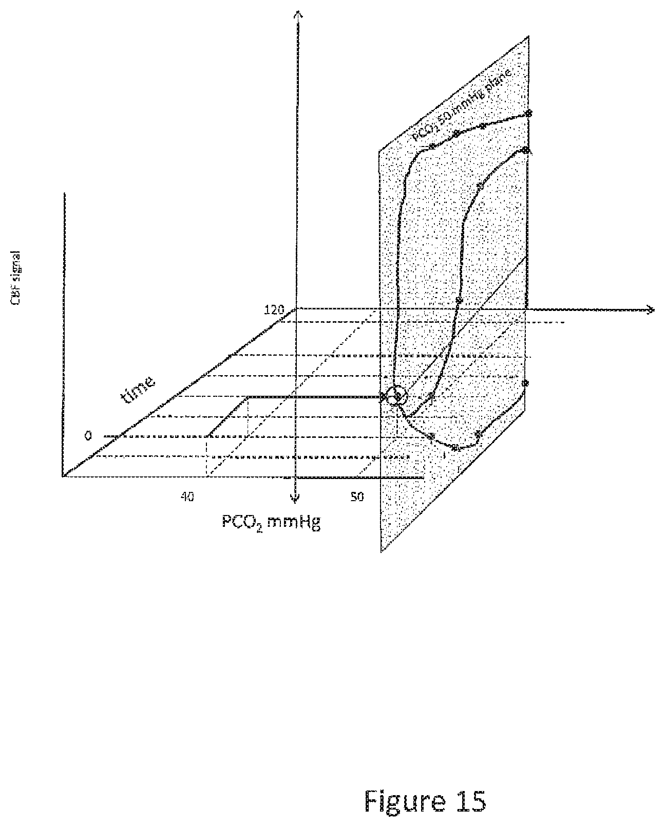 Patent US12614292 Figure 15 – Imaging abnormalities in vascular response