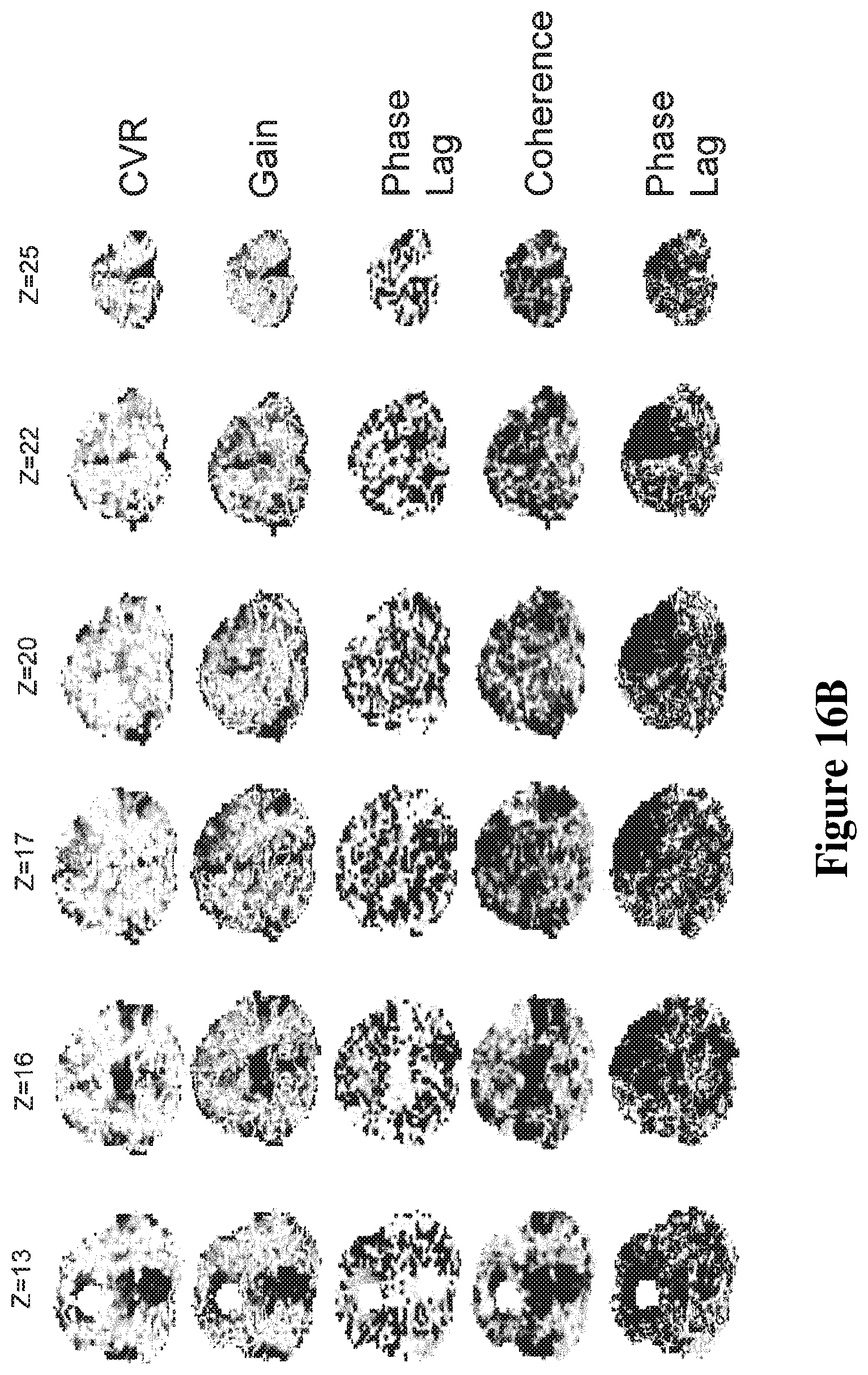 Patent US12614292 Figure 17 – Imaging abnormalities in vascular response