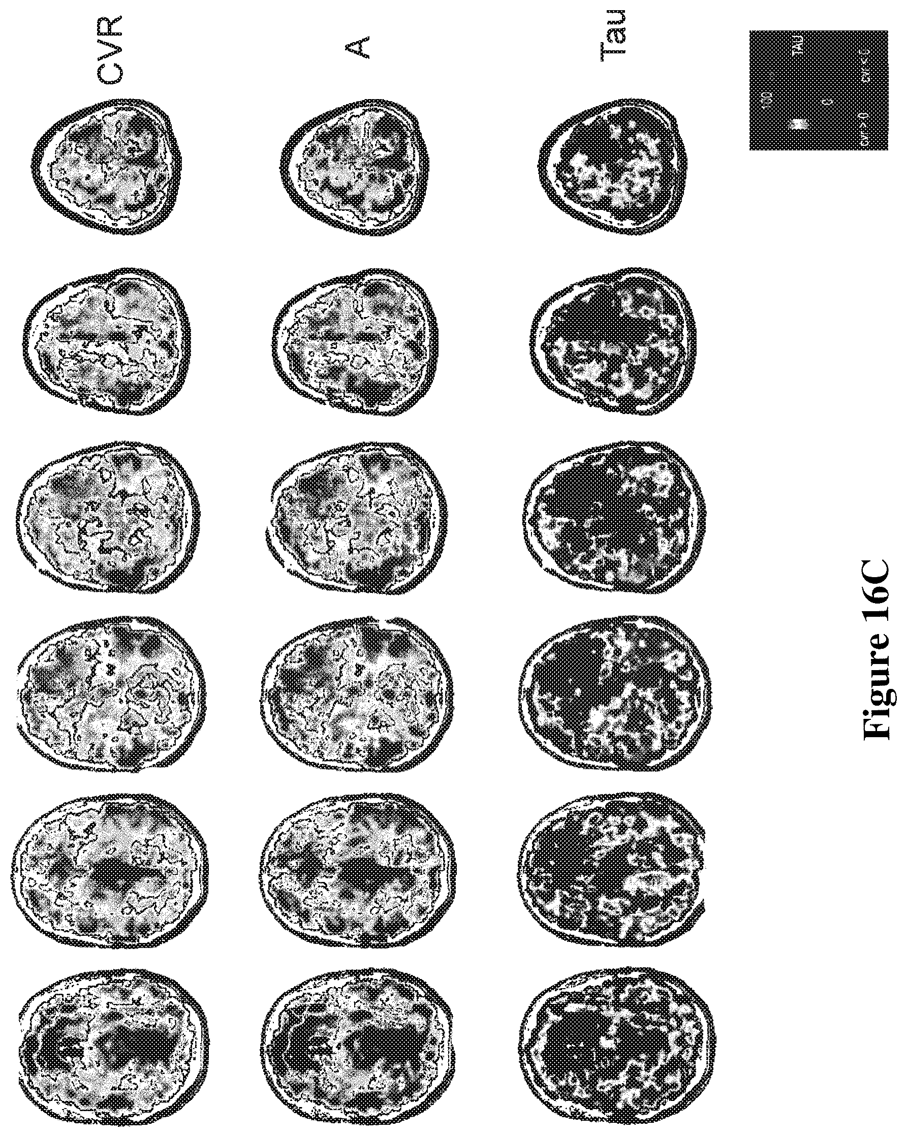 Patent US12614292 Figure 18 – Imaging abnormalities in vascular response