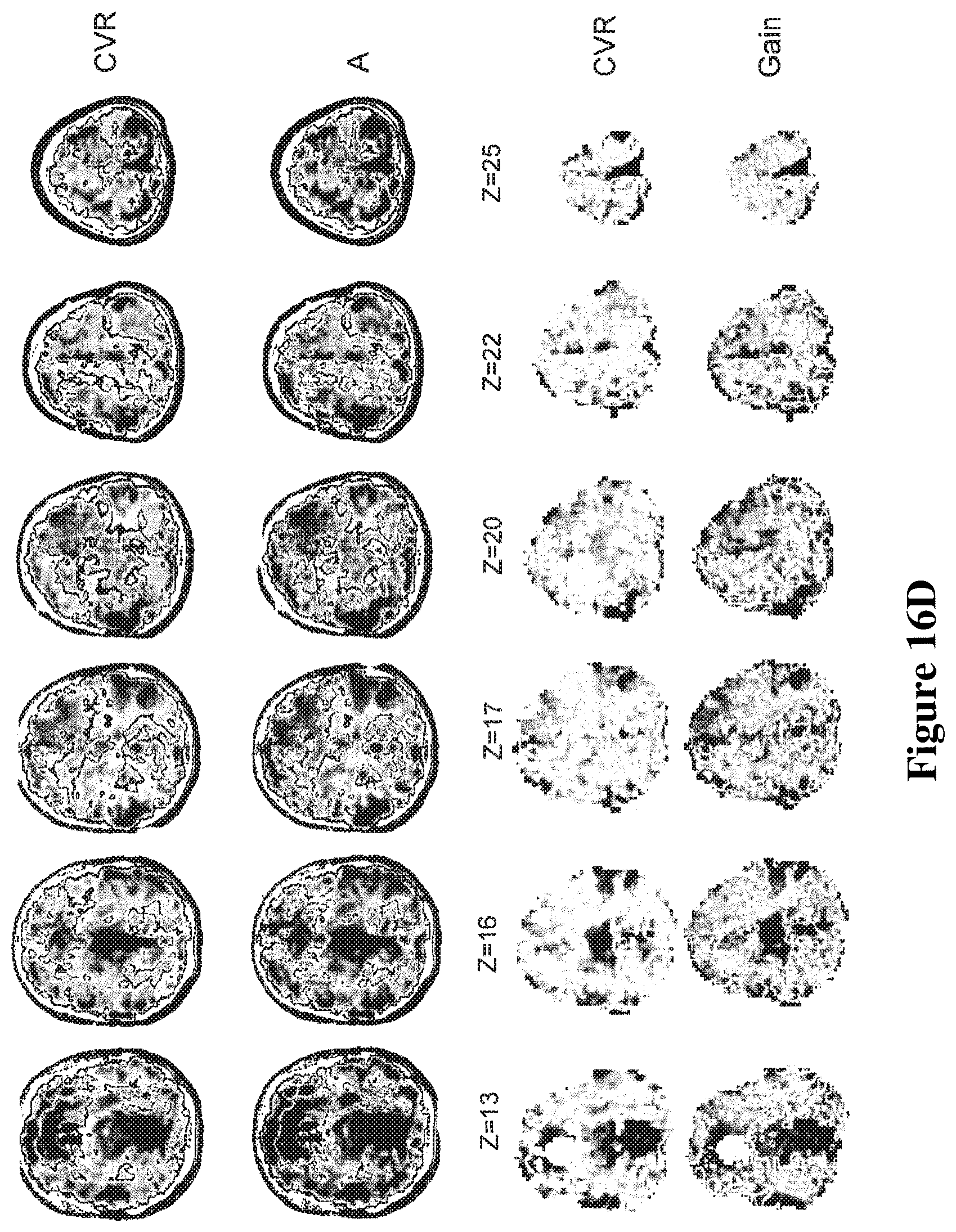 Patent US12614292 Figure 19 – Imaging abnormalities in vascular response