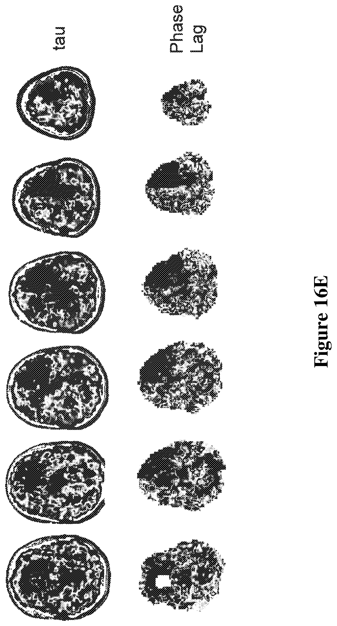 Patent US12614292 Figure 20 – Imaging abnormalities in vascular response