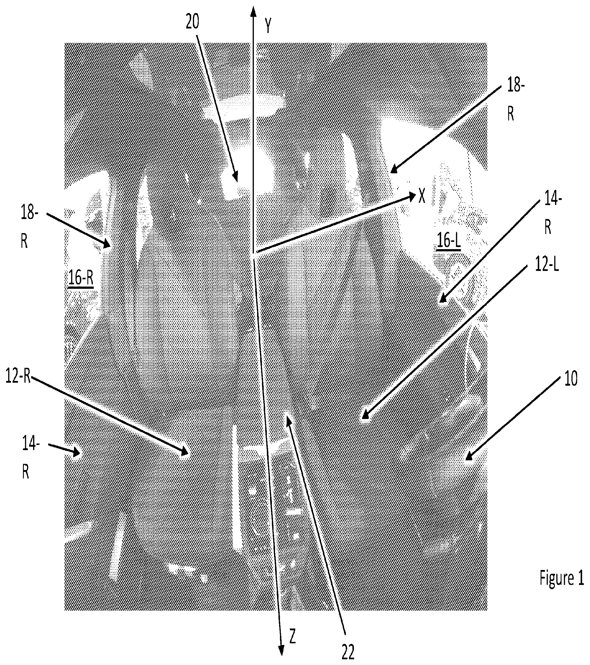 Patent US12614310 Figure 1 – Method for calibrating a vehicle cabin camera
