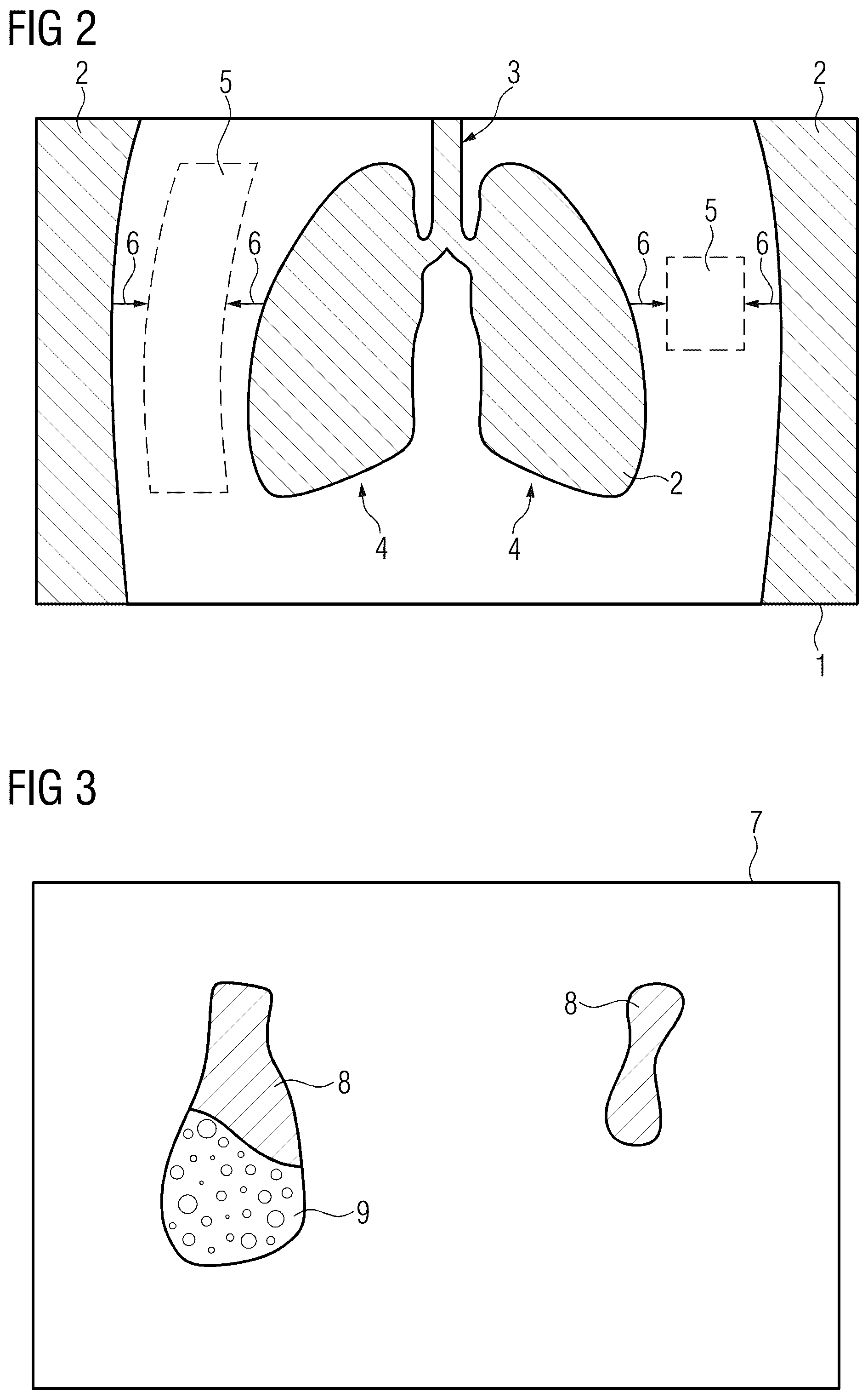 Patent US12614327 Figure 2 – Computer-implemented method for handling artifacts in multi-energy computed tomography, x-ray imaging device, computer program and electronically readable storage medium