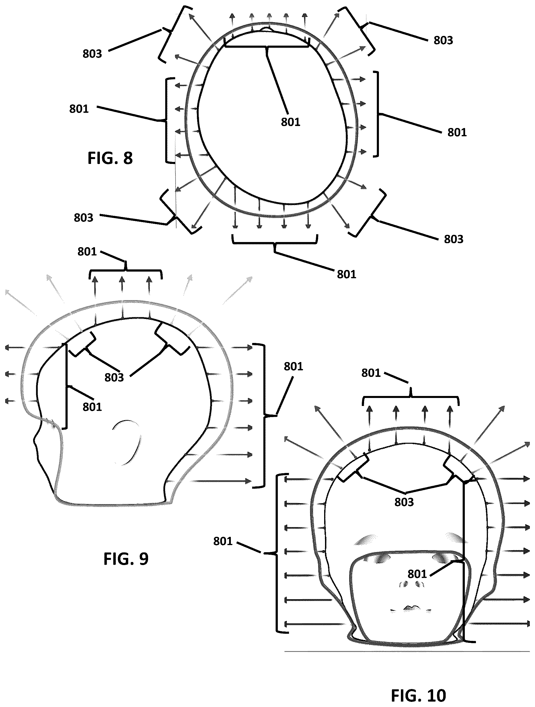Patent US12614362 Figure 5 – Custom cranial remodeling devices manufactured by additive manufacture
