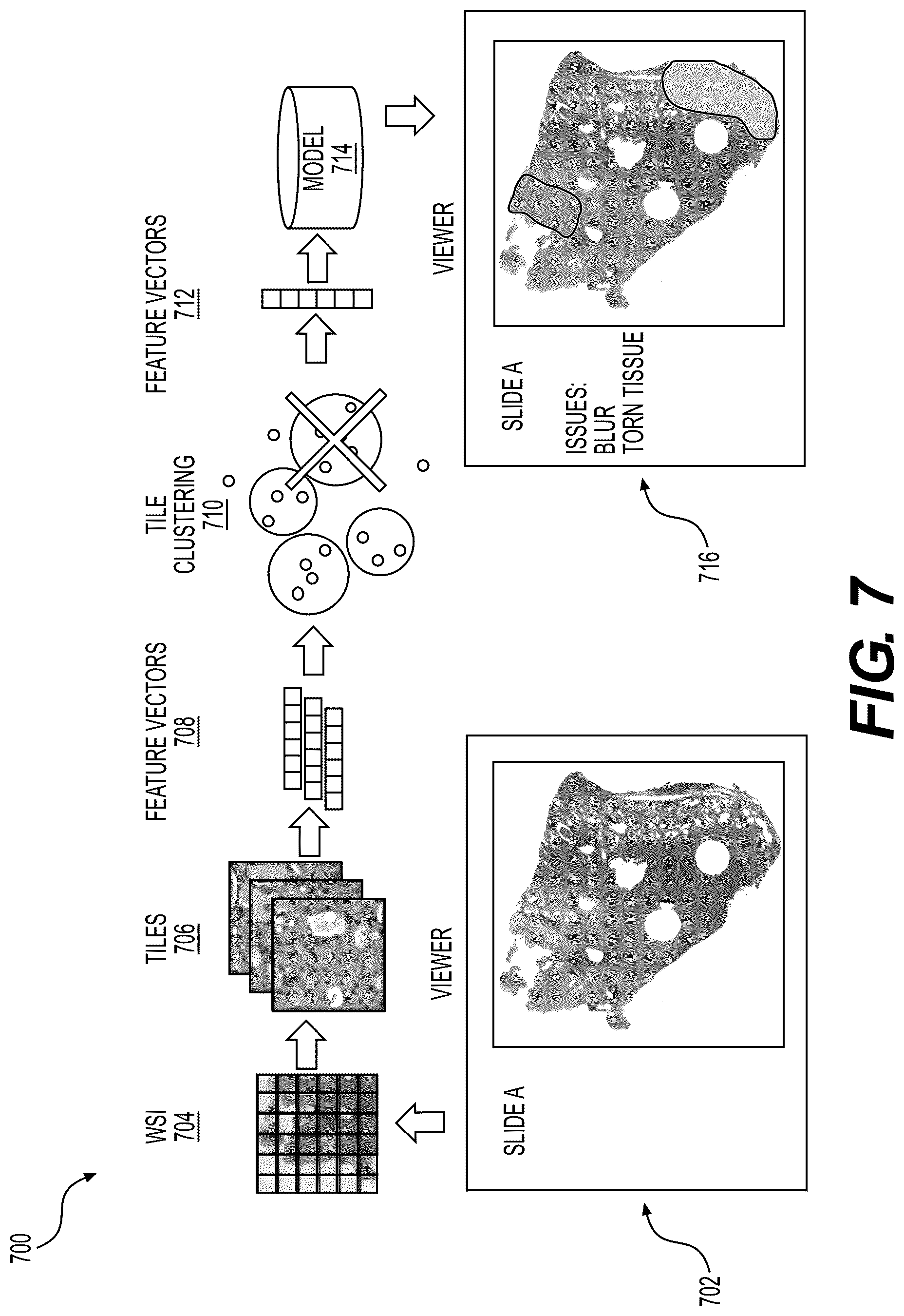 Patent US12614378 Figure 11 – Systems and methods to process electronic images to determine histopathology quality