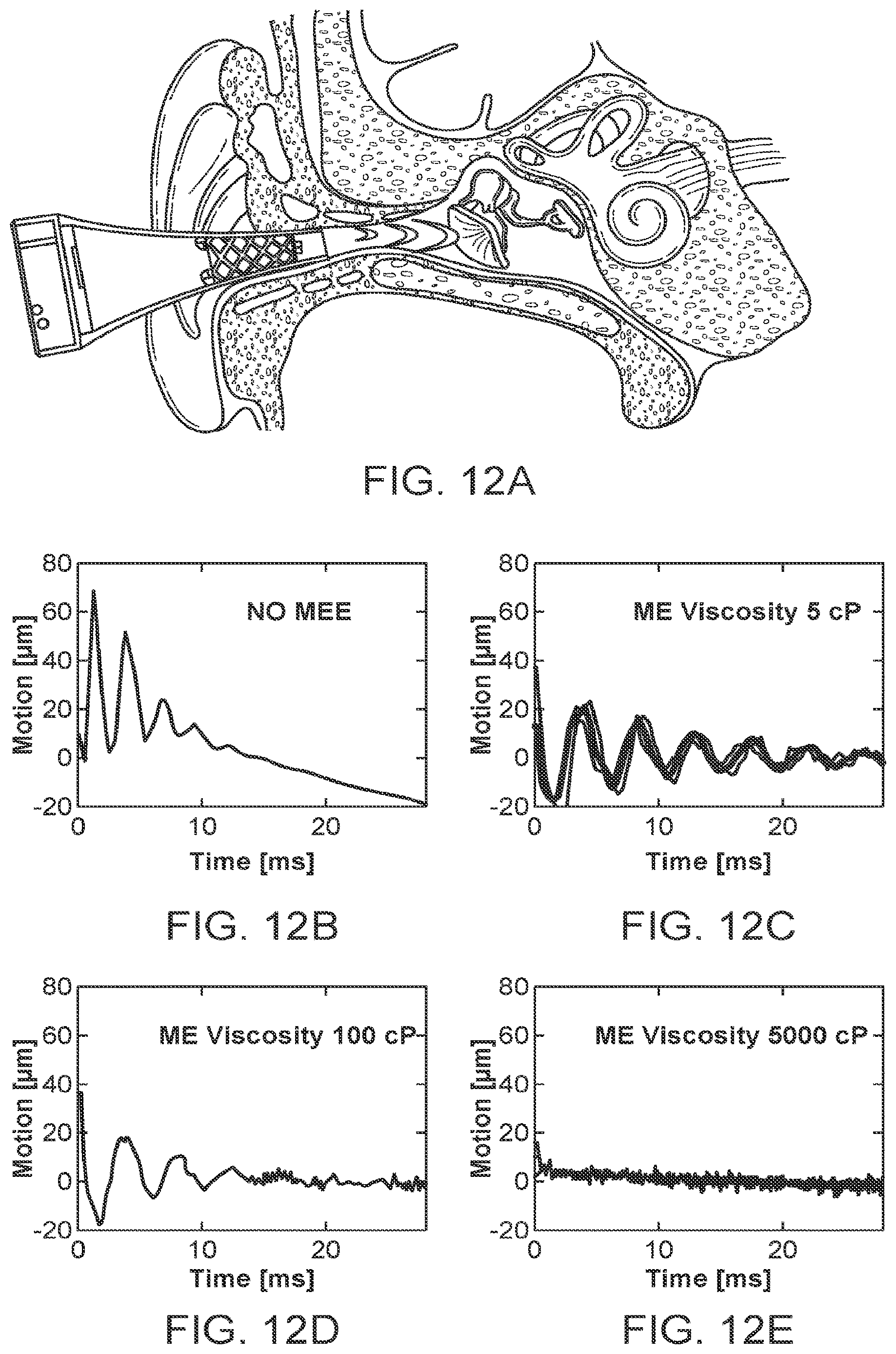 Patent US12614474 Figure 15 – Systems and methods for simulating a tympanic membrane