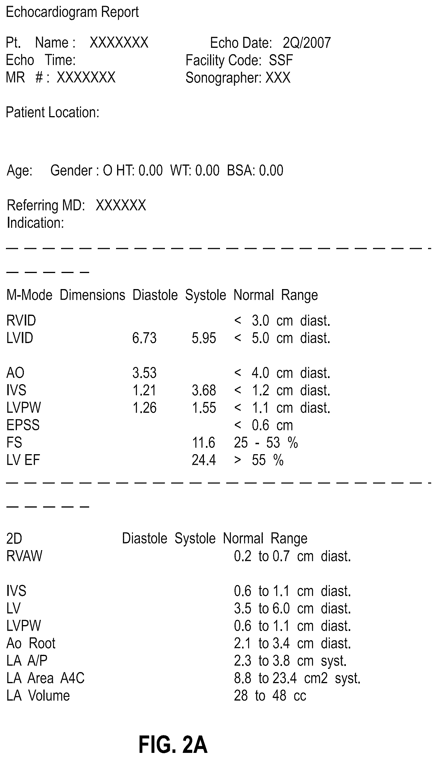 Patent US12614616 Figure 2 – Workflow for automatic measurement of doppler pipeline