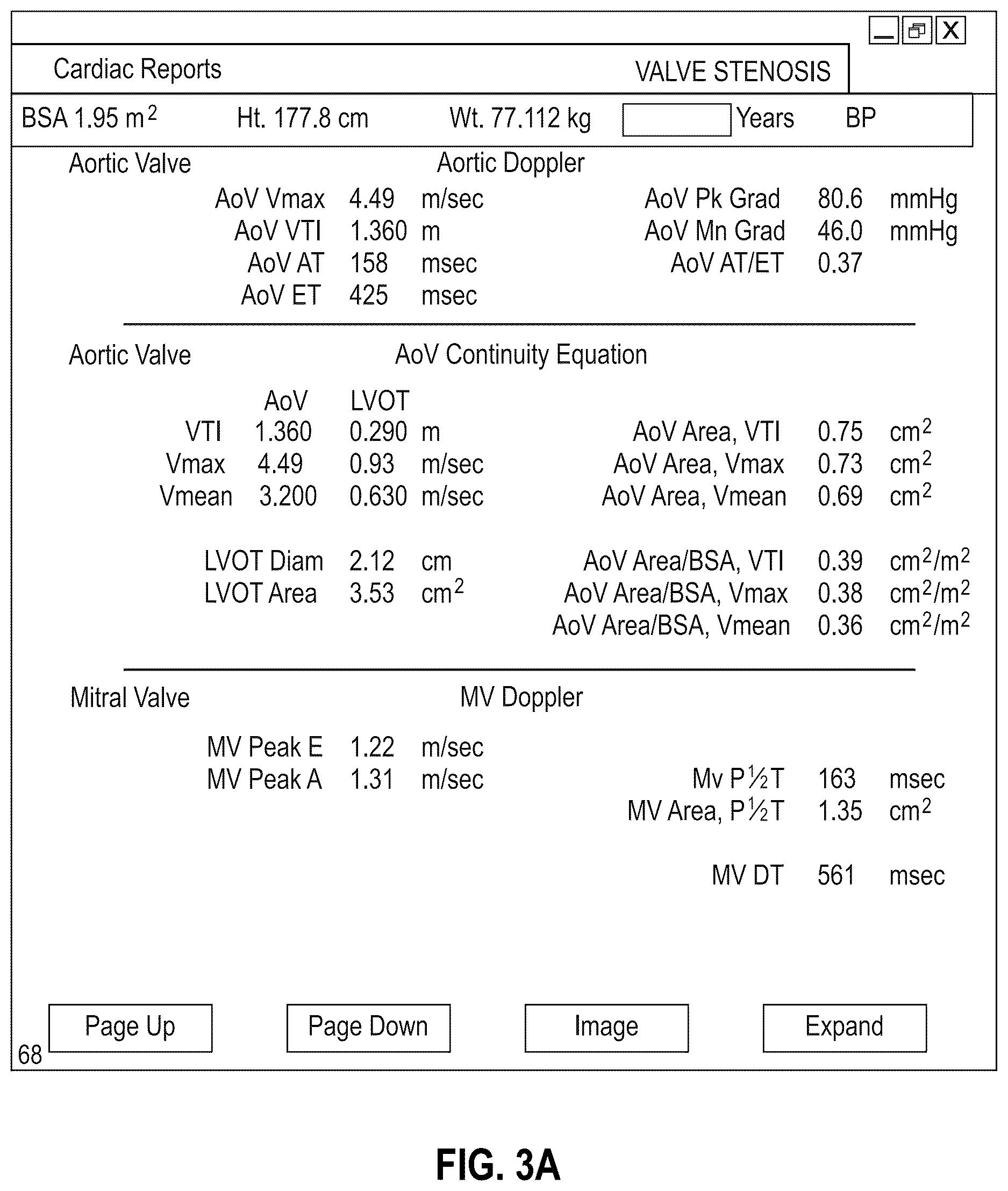 Patent US12614616 Figure 4 – Workflow for automatic measurement of doppler pipeline