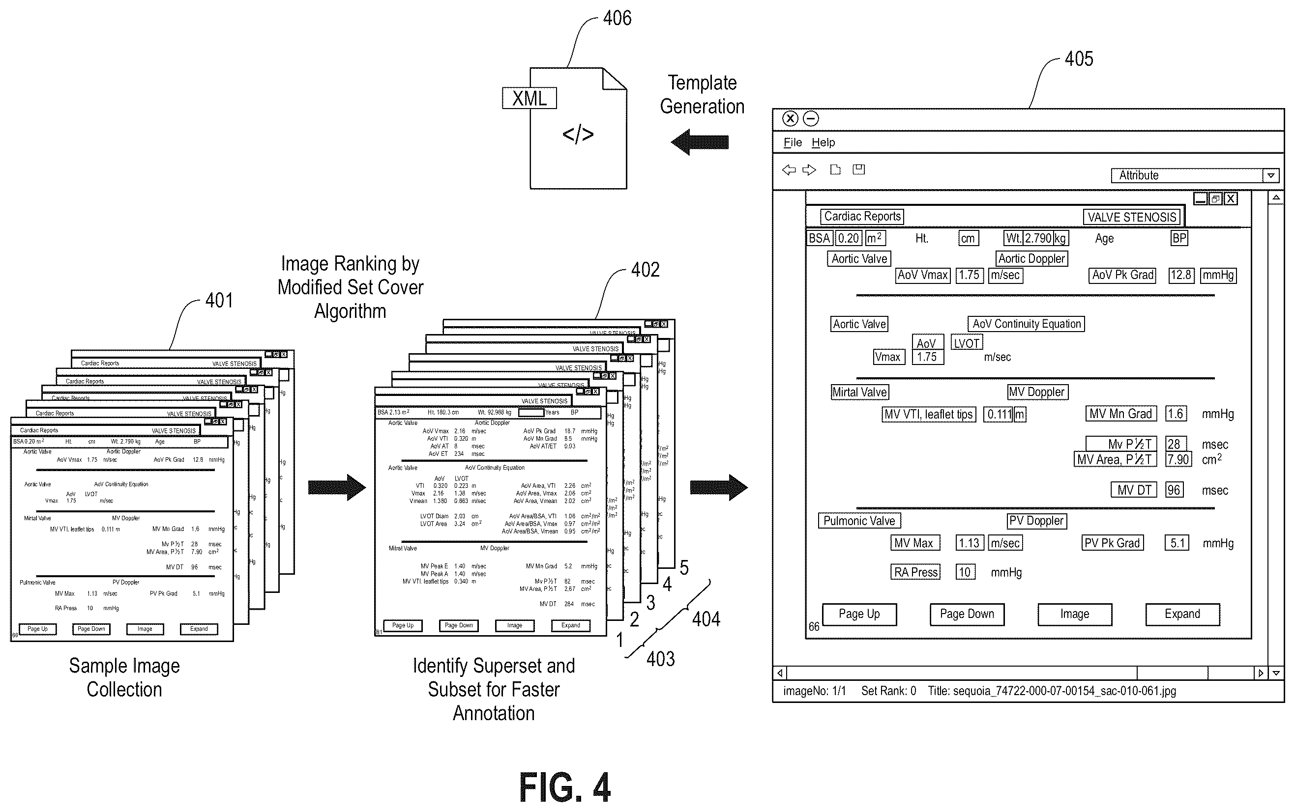 Patent US12614616 Figure 7 – Workflow for automatic measurement of doppler pipeline