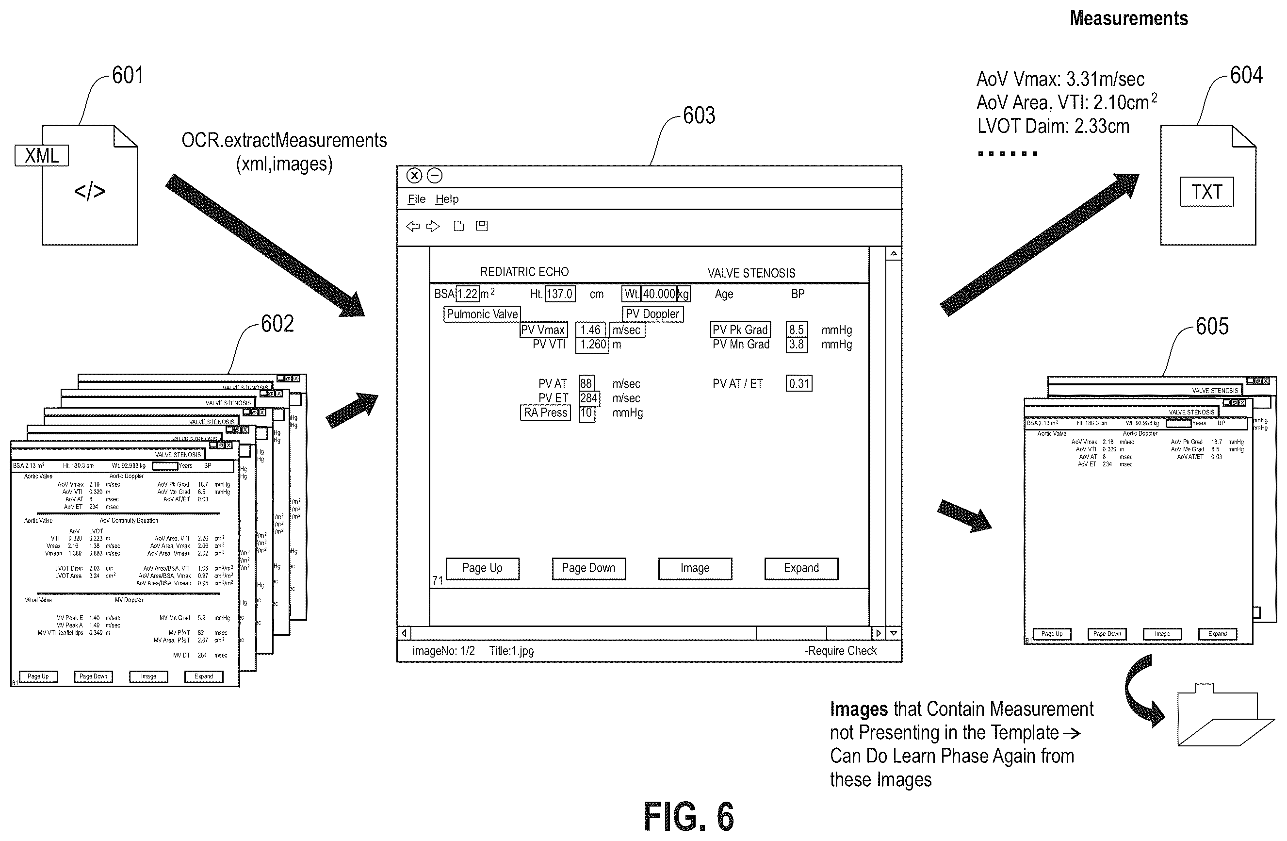 Patent US12614616 Figure 9 – Workflow for automatic measurement of doppler pipeline