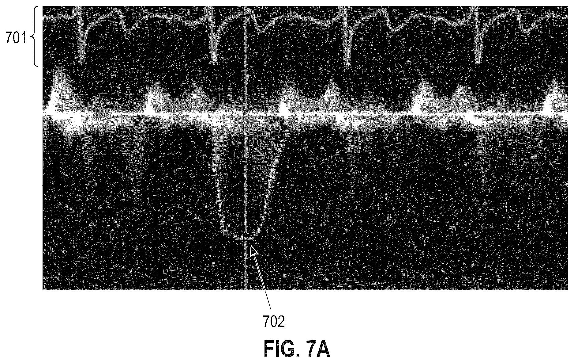 Patent US12614616 Figure 10 – Workflow for automatic measurement of doppler pipeline