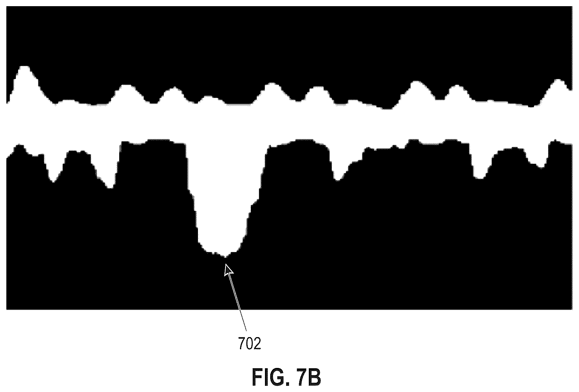 Patent US12614616 Figure 11 – Workflow for automatic measurement of doppler pipeline