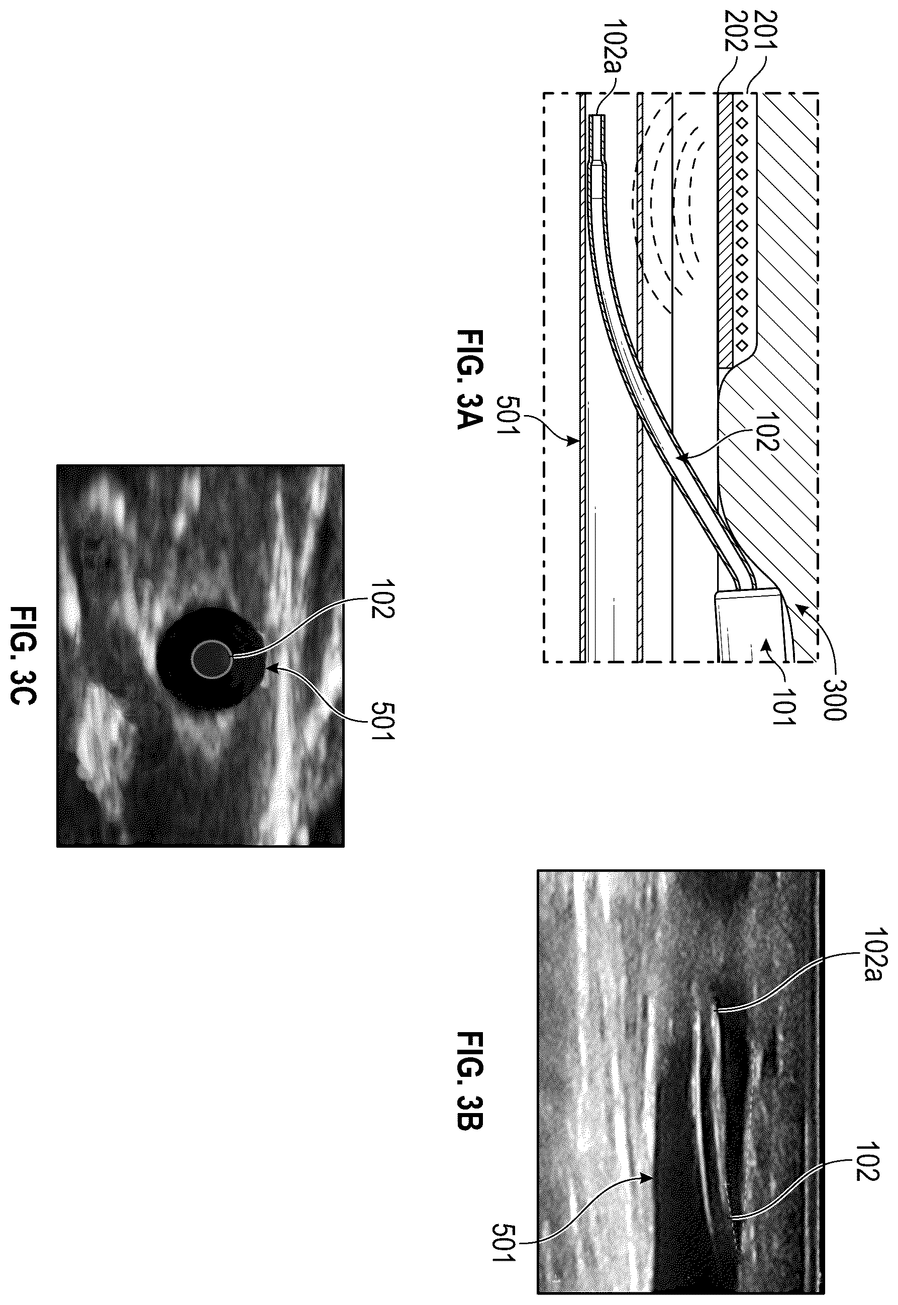 Patent US12614617 Figure 5 – Collecting and connecting vascular access data throughout the continuity of care