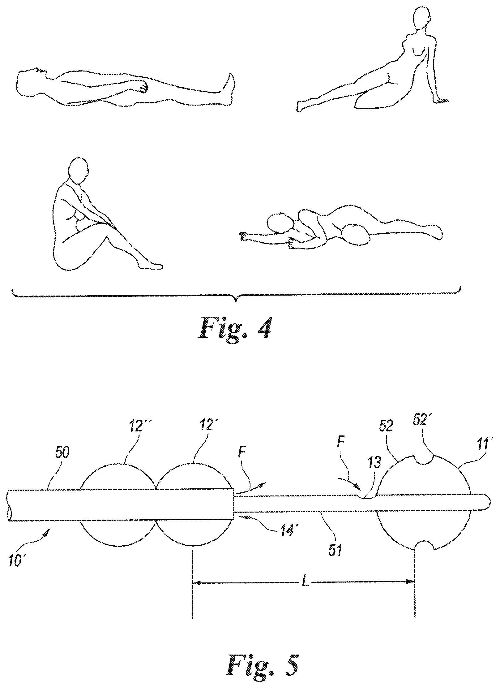 Patent US12614623 Figure 3 – Planning and navigation in superselective drug delivery via the tracheobronchial airway