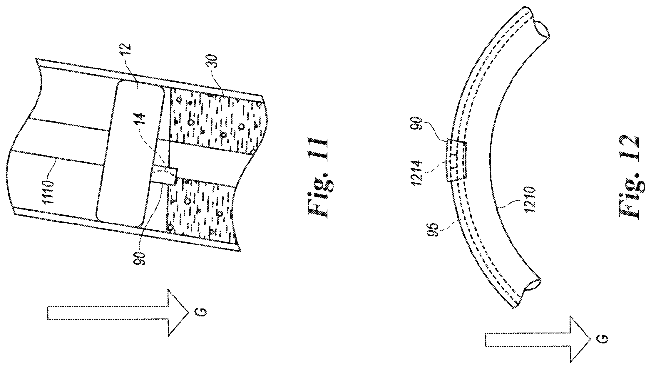 Patent US12614623 Figure 9 – Planning and navigation in superselective drug delivery via the tracheobronchial airway