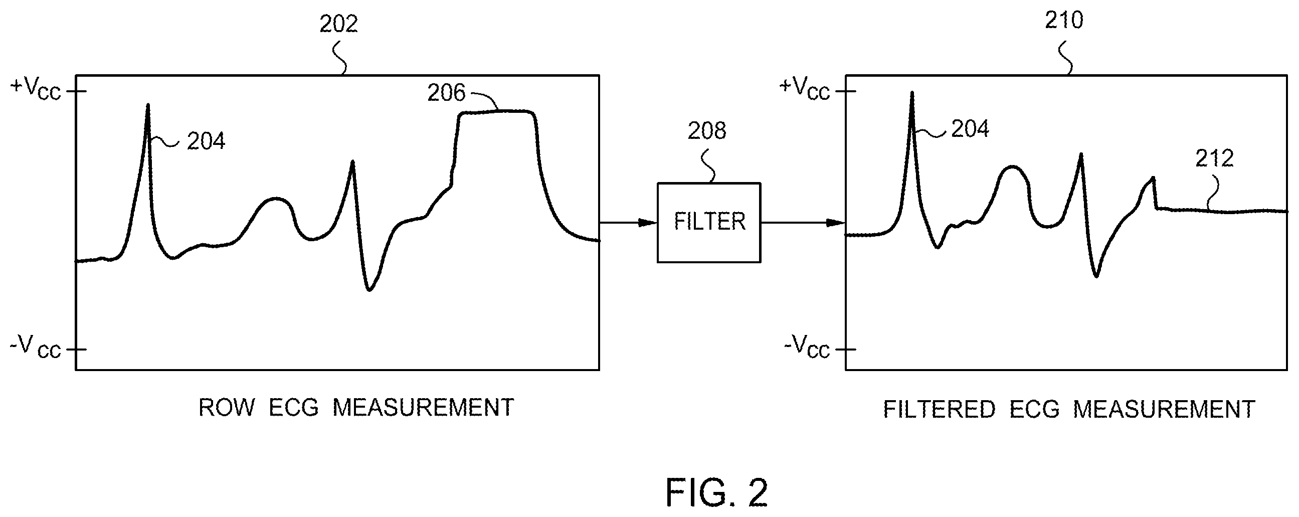 Patent US12614633 Figure 2 – Electrocardiogram wave segmentation using machine learning