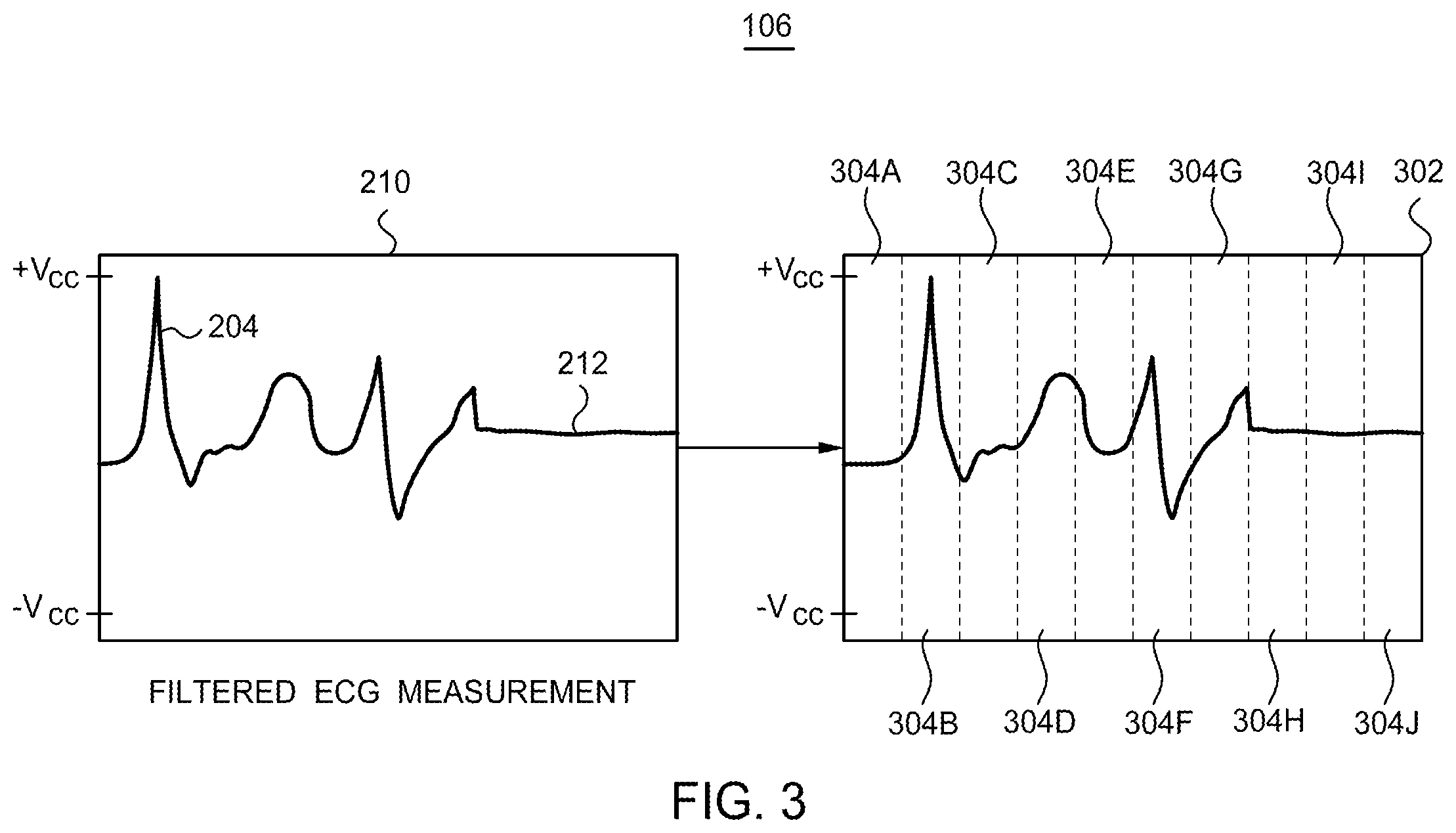 Patent US12614633 Figure 3 – Electrocardiogram wave segmentation using machine learning