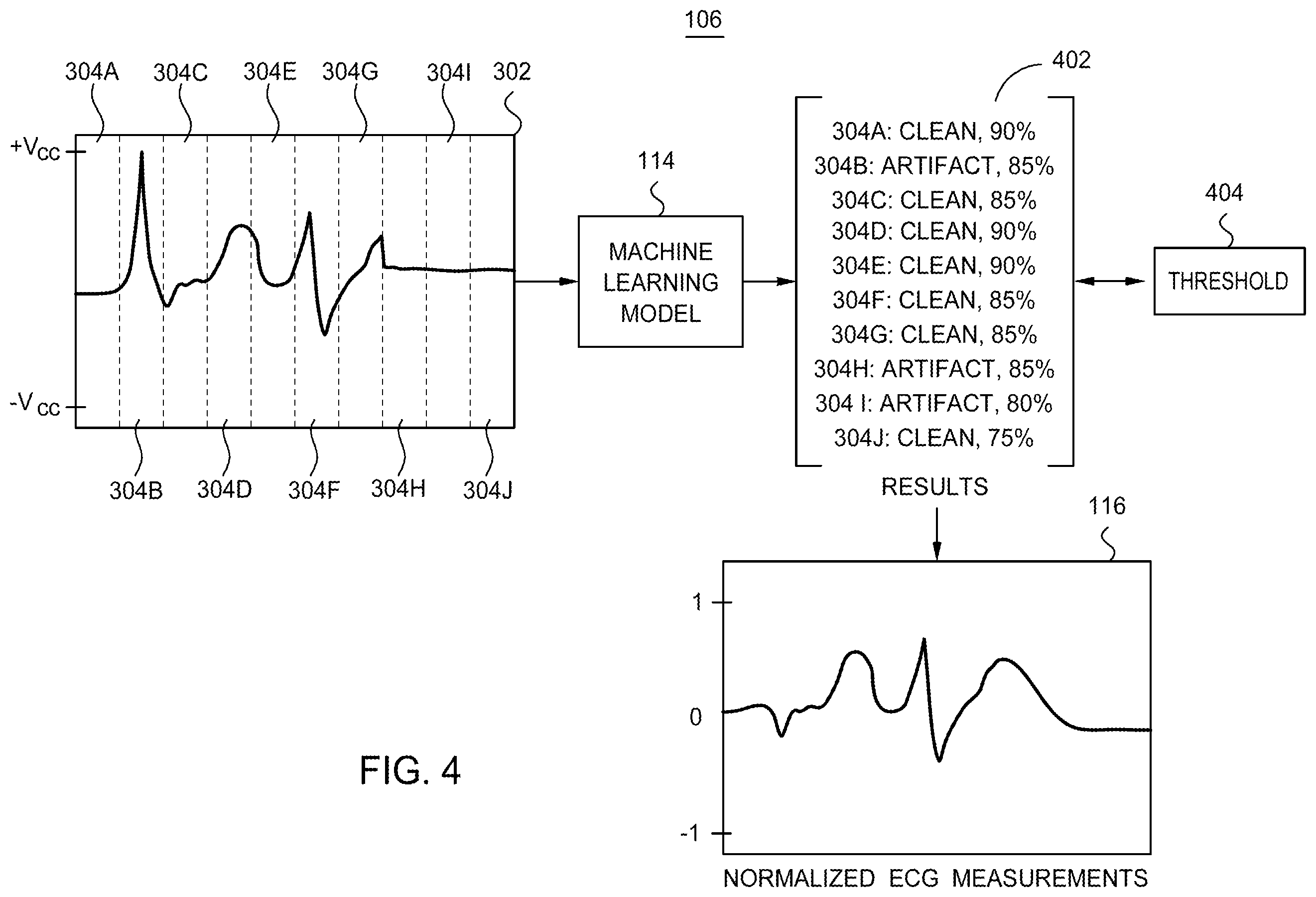 Patent US12614633 Figure 4 – Electrocardiogram wave segmentation using machine learning