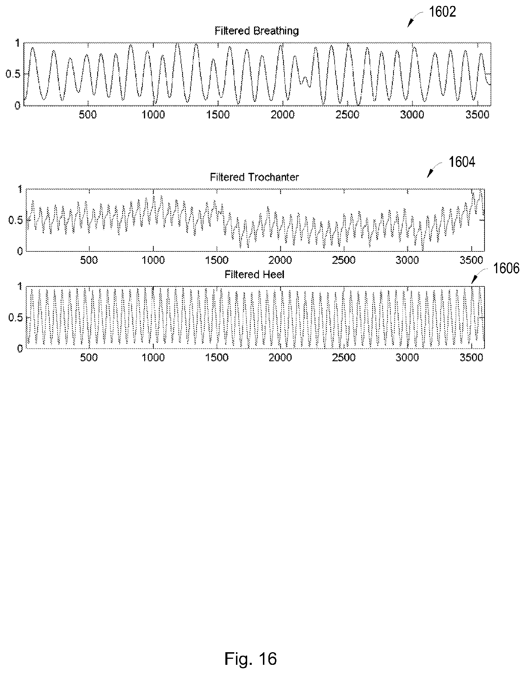 Patent US12614635 Figure 13 – Systems and techniques for estimating the severity of chronic obstructive pulmonary disease in a patient
