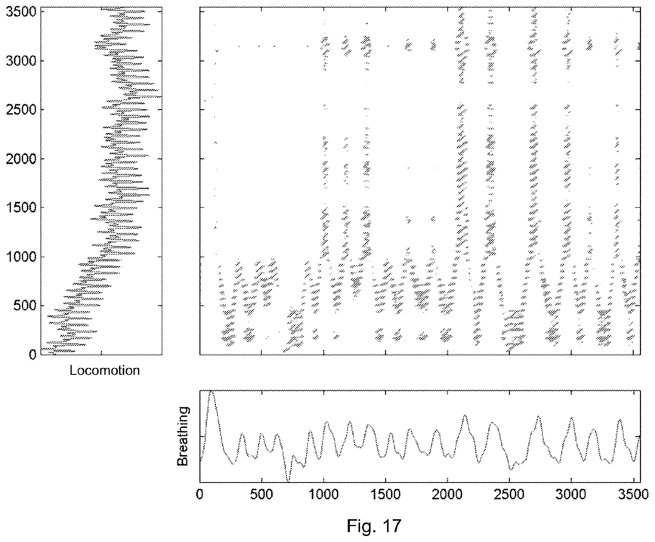 Patent US12614635 Figure 14 – Systems and techniques for estimating the severity of chronic obstructive pulmonary disease in a patient