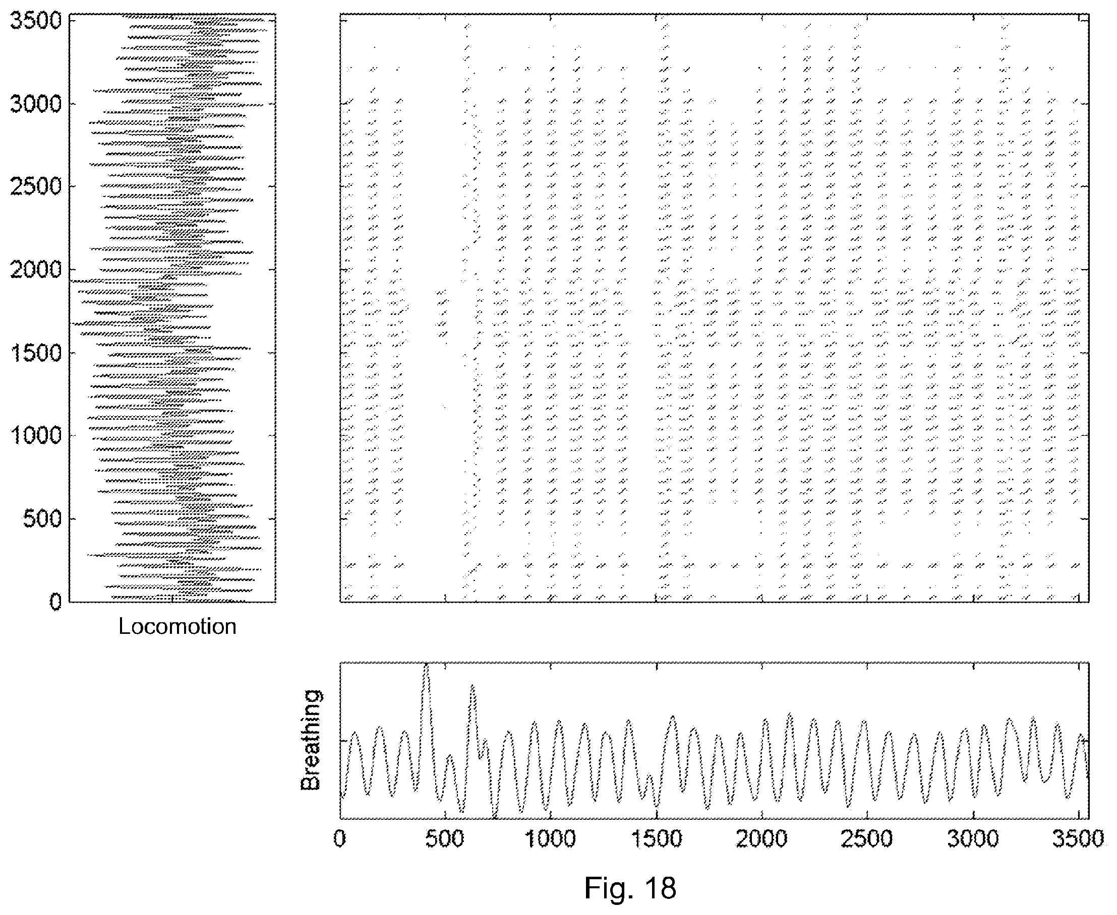 Patent US12614635 Figure 15 – Systems and techniques for estimating the severity of chronic obstructive pulmonary disease in a patient