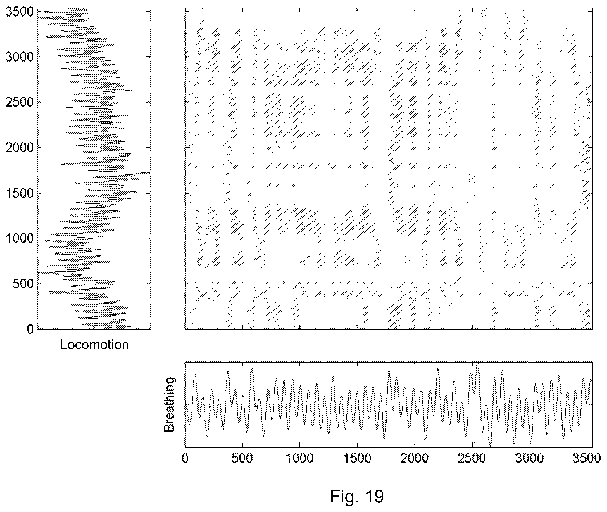 Patent US12614635 Figure 16 – Systems and techniques for estimating the severity of chronic obstructive pulmonary disease in a patient