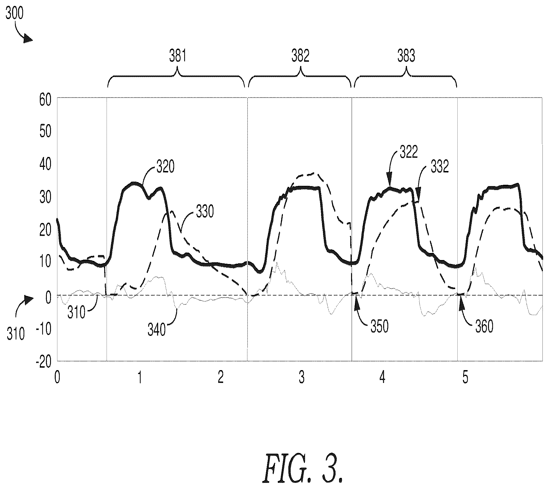 Patent US12614636 Figure 4 – Patient ventilator asynchrony detection