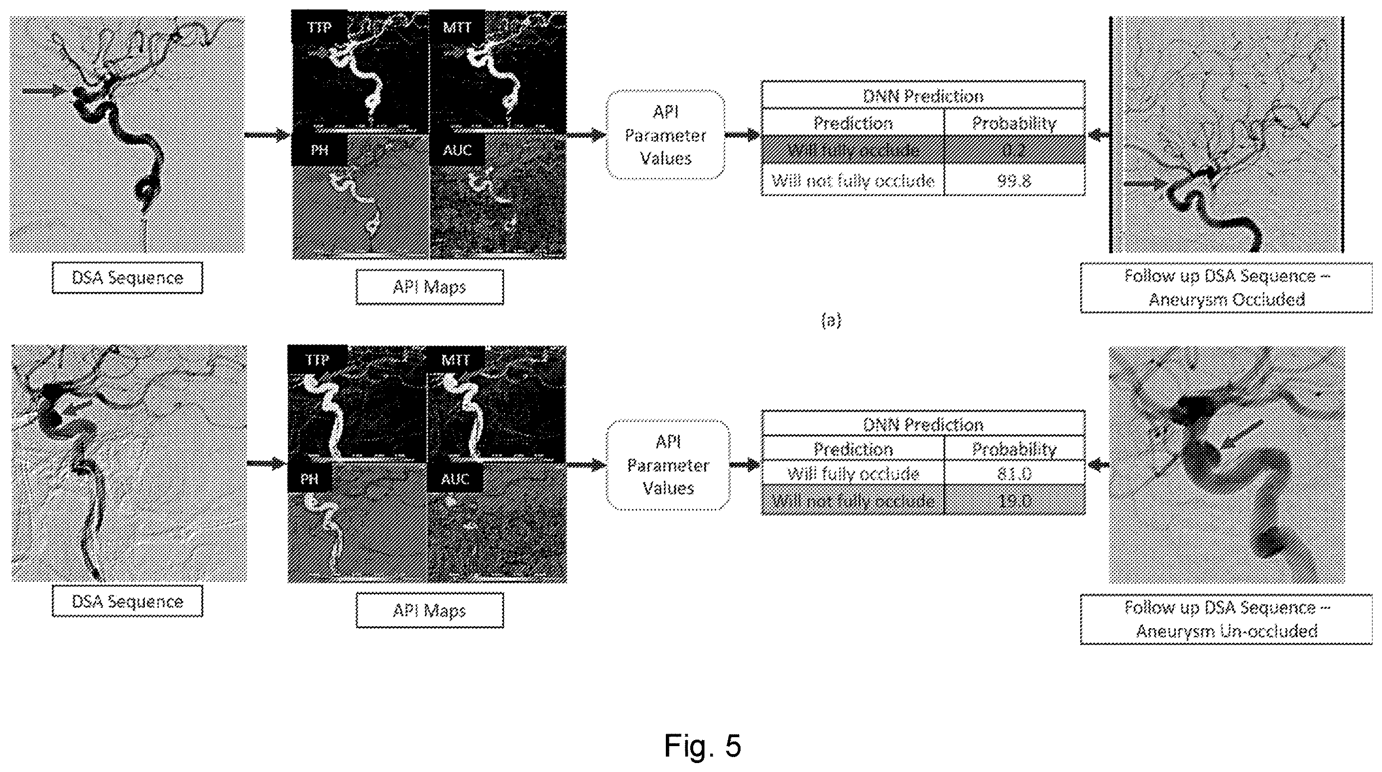 Patent US12614638 Figure 4 – Method for assessing vasculature, obtaining angiographic parametric imaging (API) maps of vasculature and determining state of vasculature using machine-learning classifier