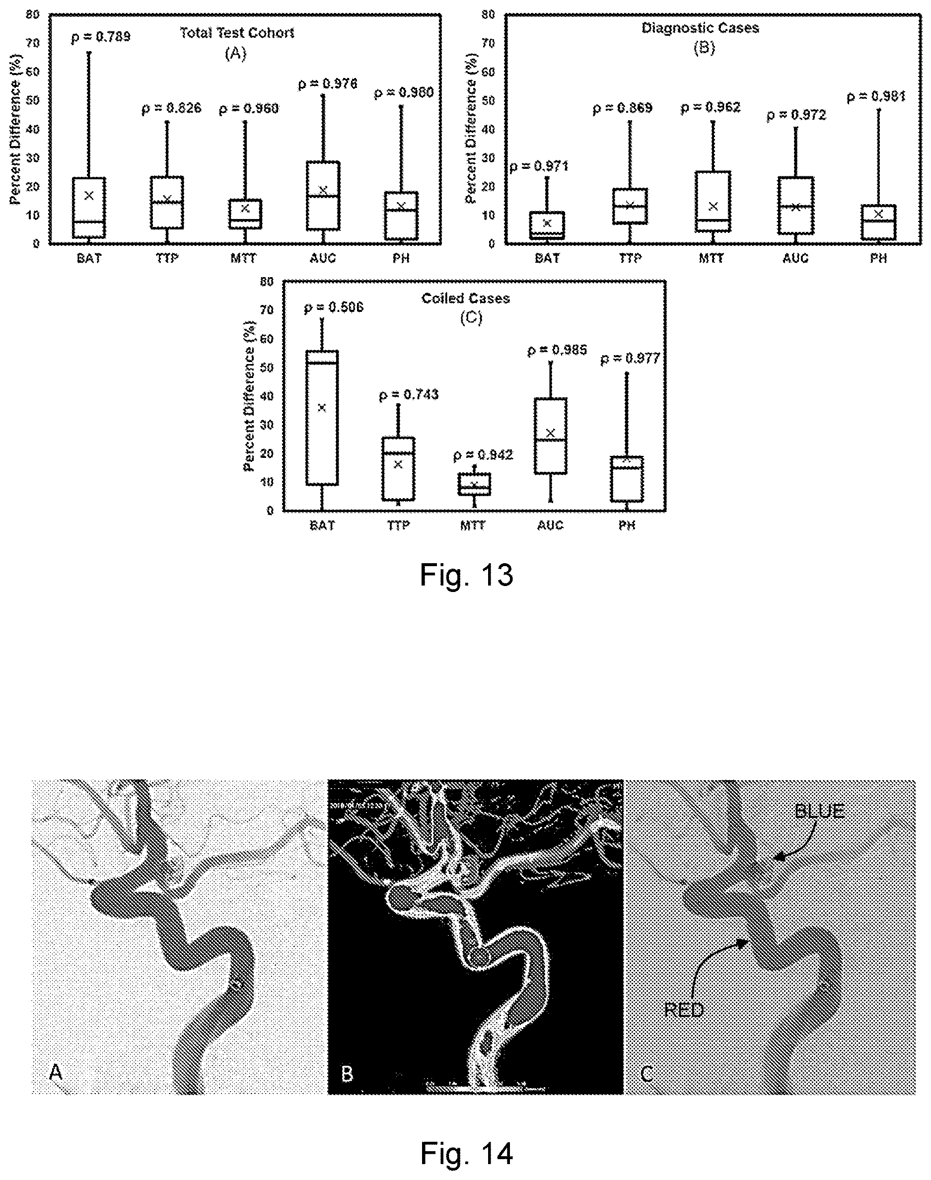 Patent US12614638 Figure 12 – Method for assessing vasculature, obtaining angiographic parametric imaging (API) maps of vasculature and determining state of vasculature using machine-learning classifier